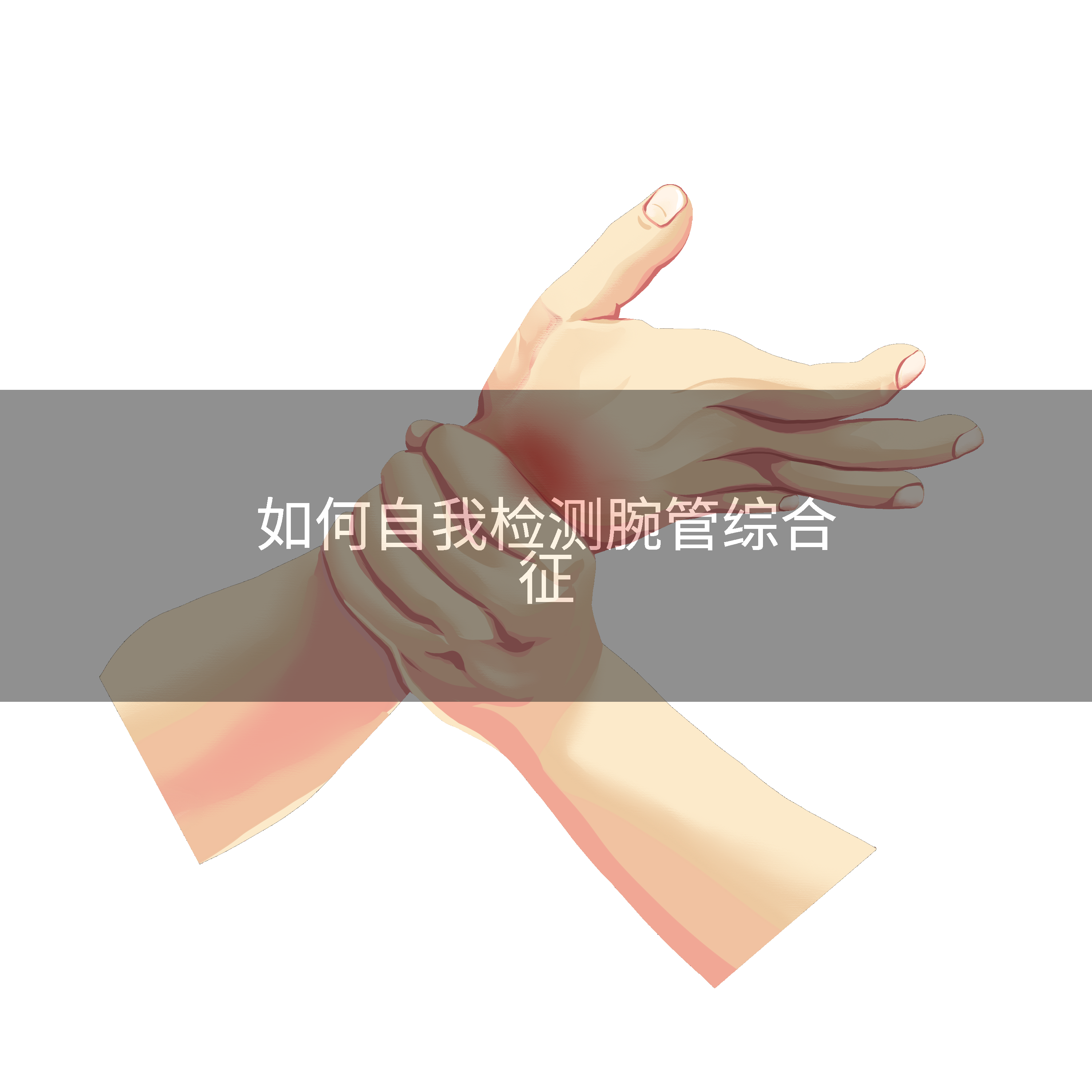 如何自我检测腕管综合征