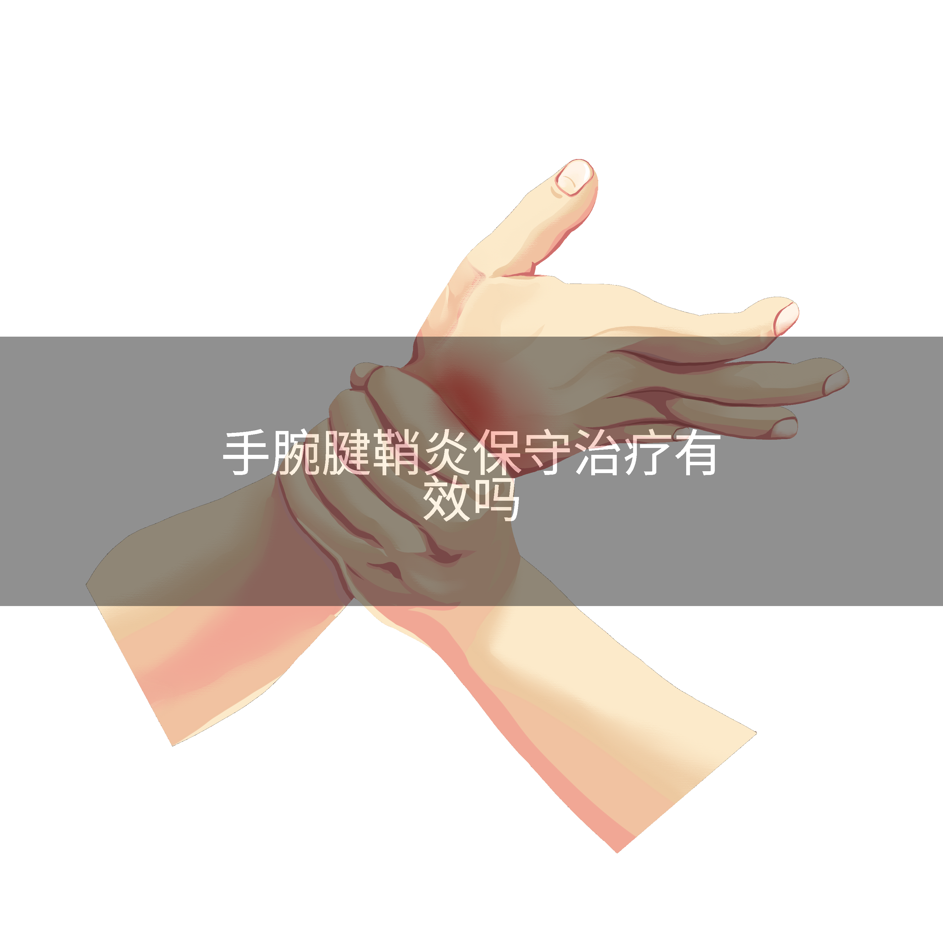手腕腱鞘炎保守治疗有效吗