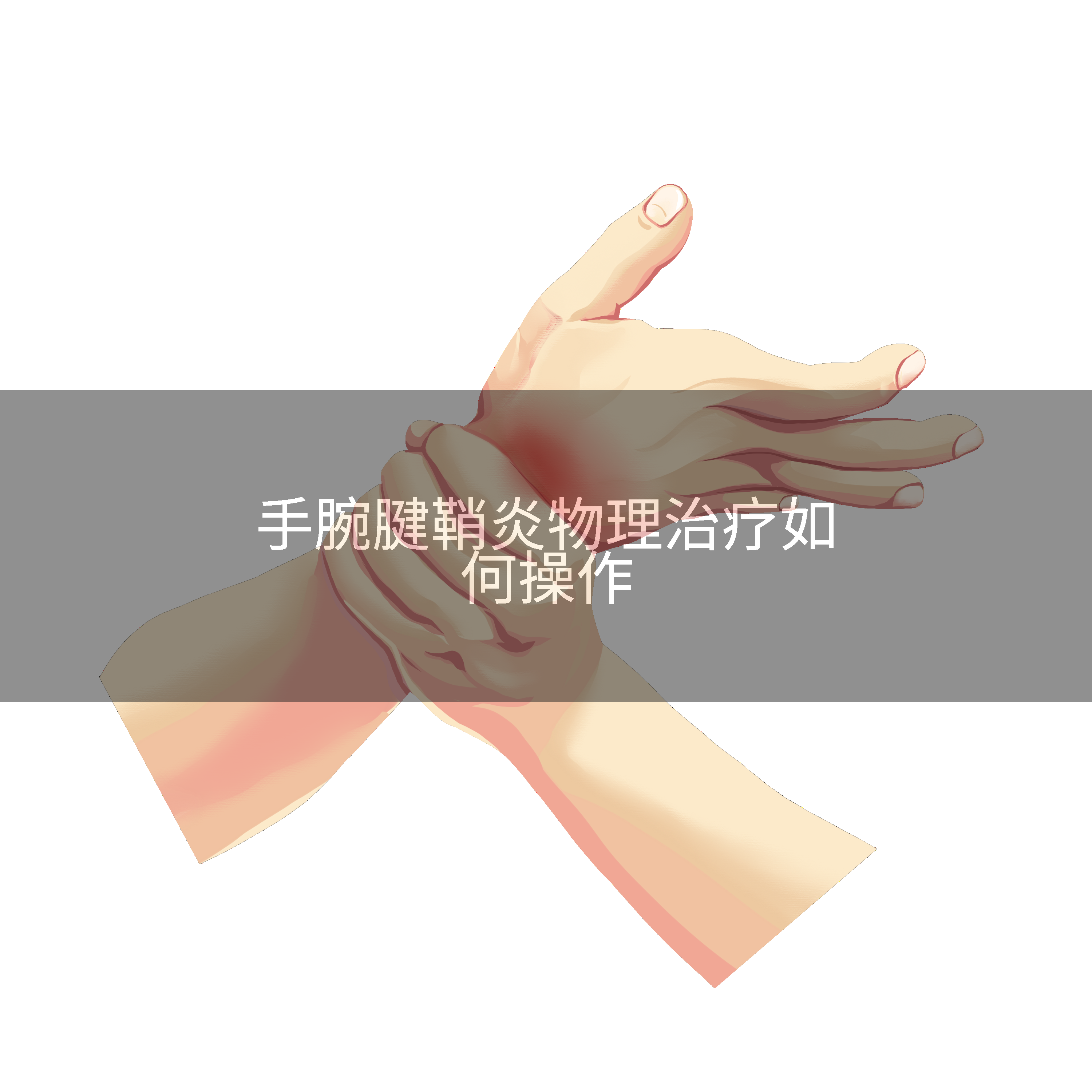 手腕腱鞘炎物理治疗如何操作