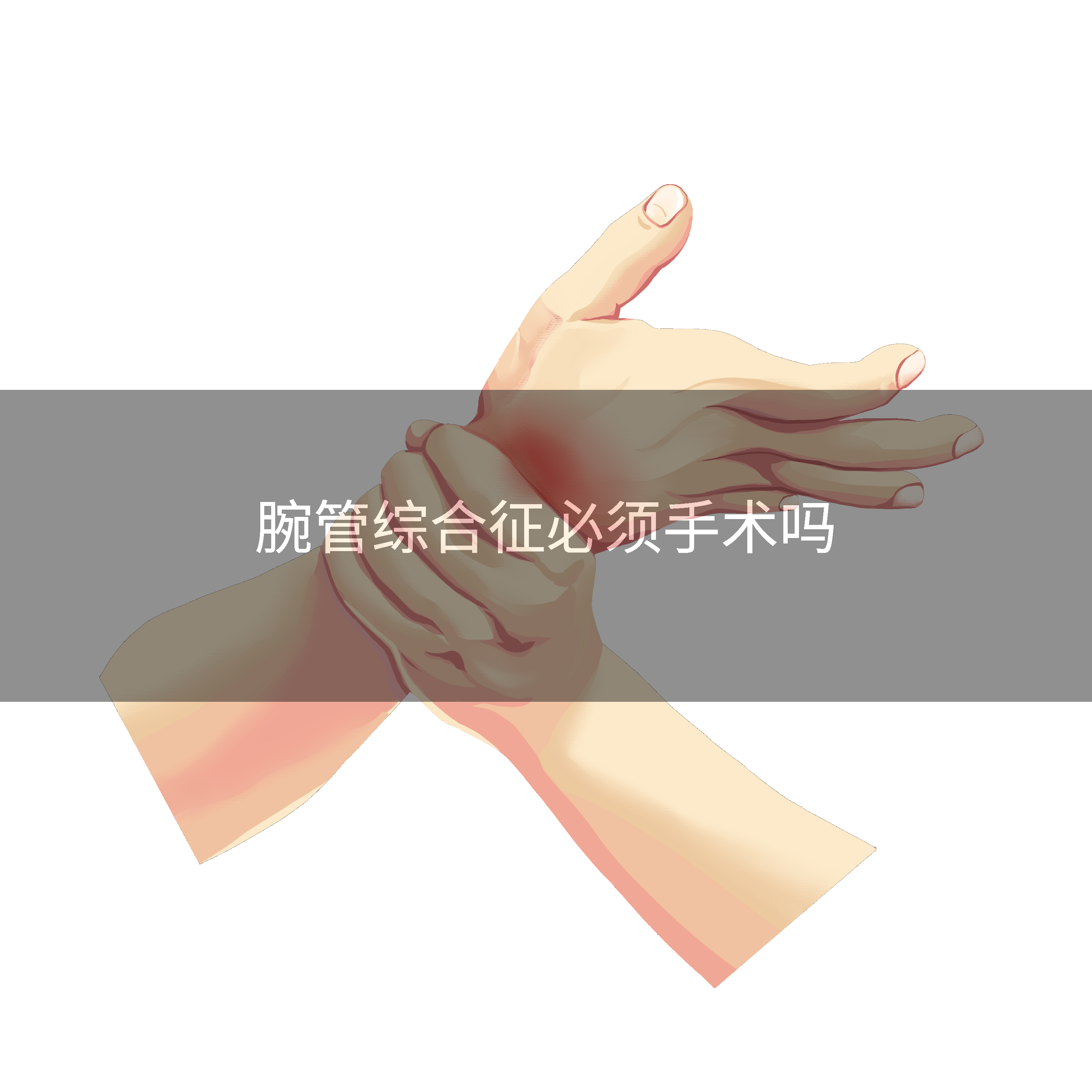 腕管综合征必须手术吗