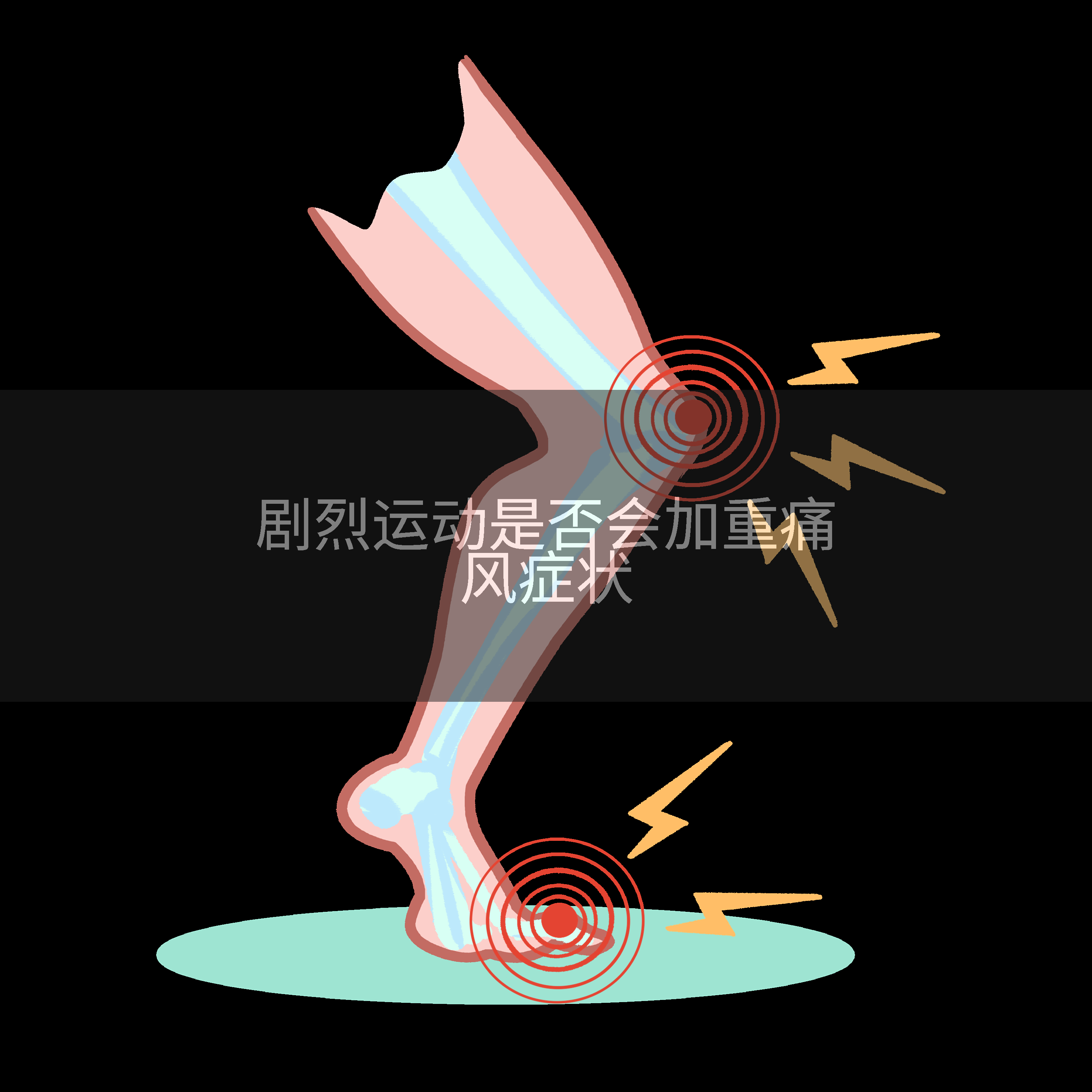 剧烈运动是否会加重痛风症状