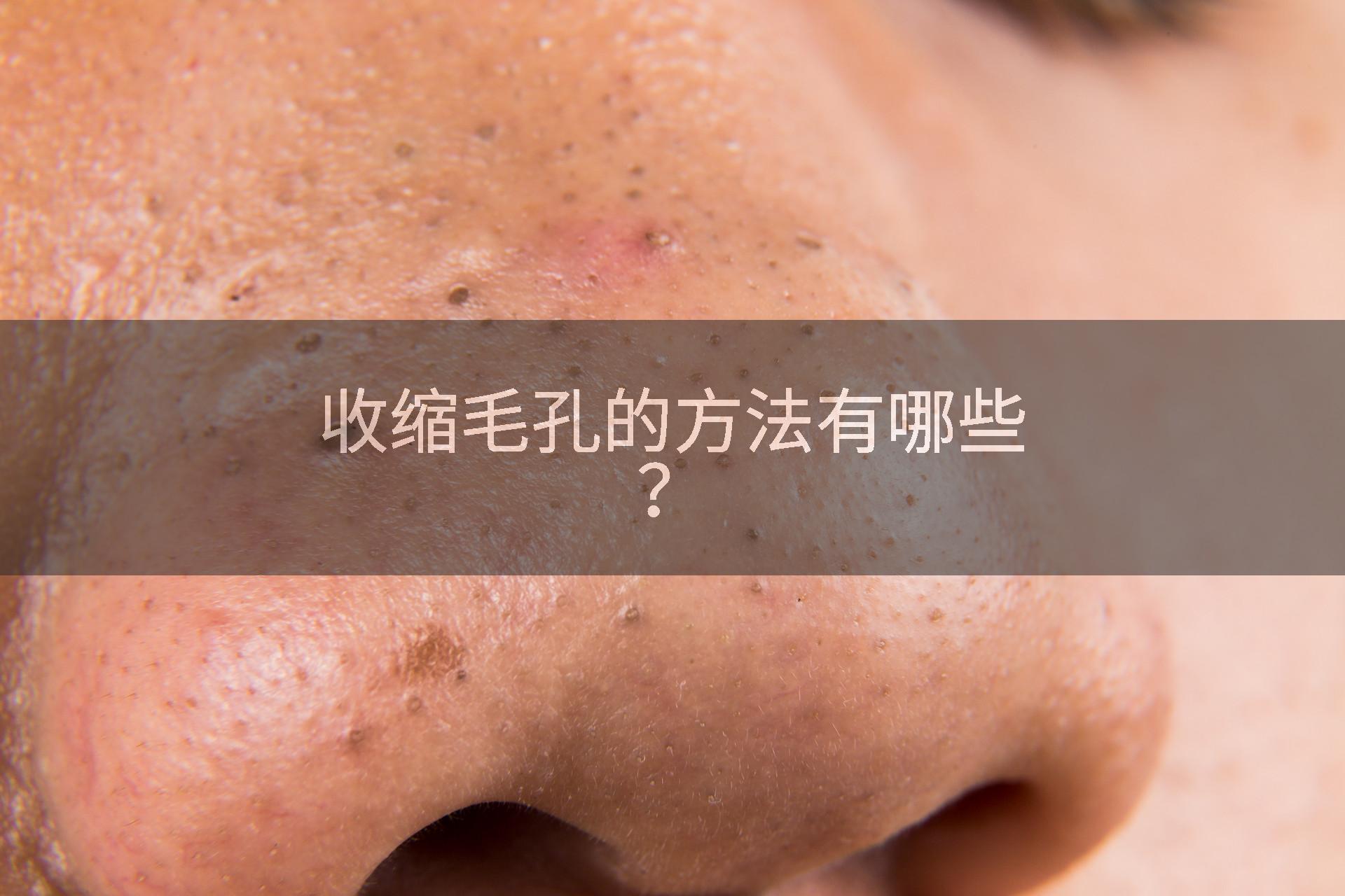 收缩毛孔的方法有哪些？