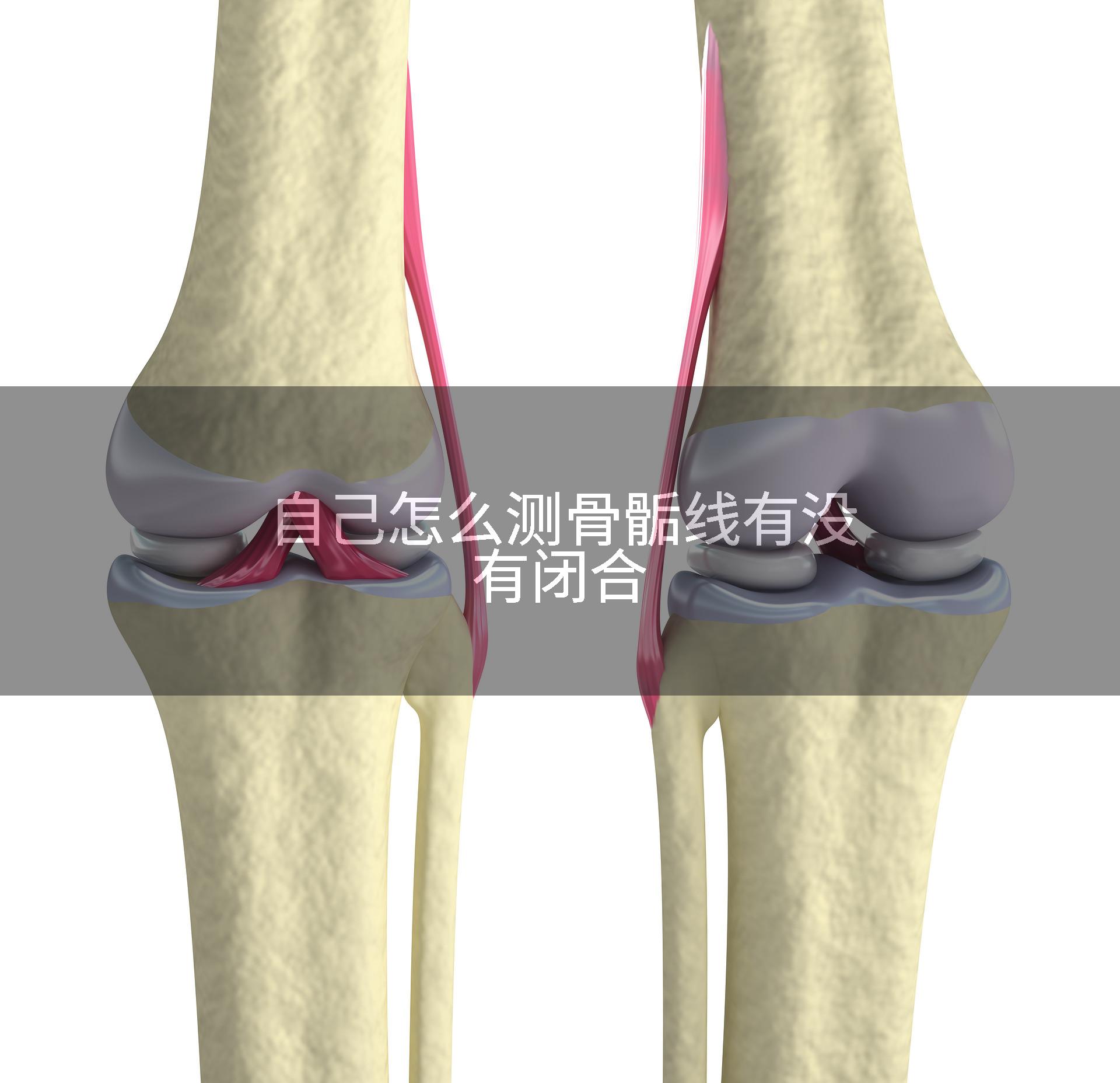 自己怎么测骨骺线有没有闭合