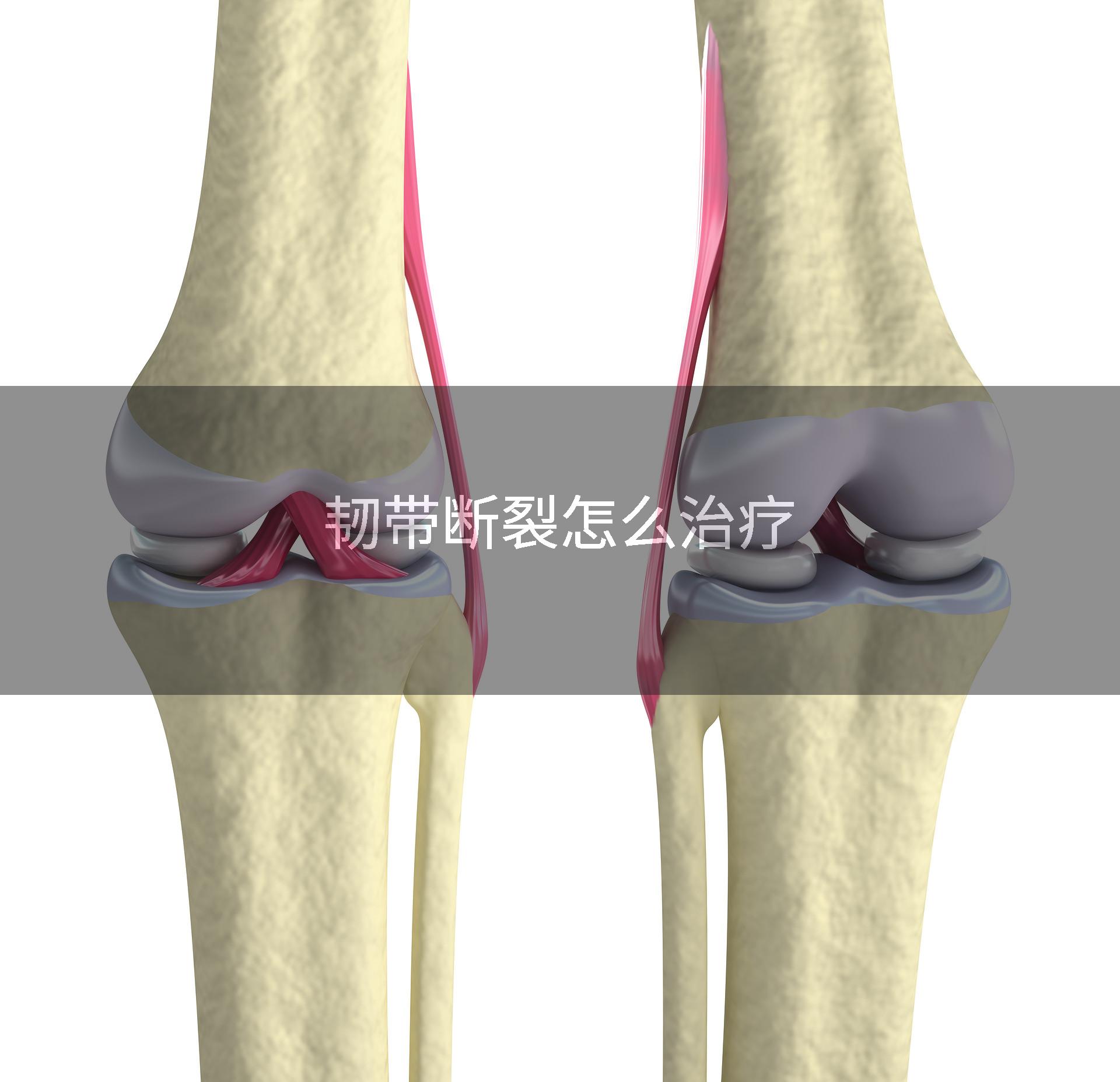 韧带断裂怎么治疗