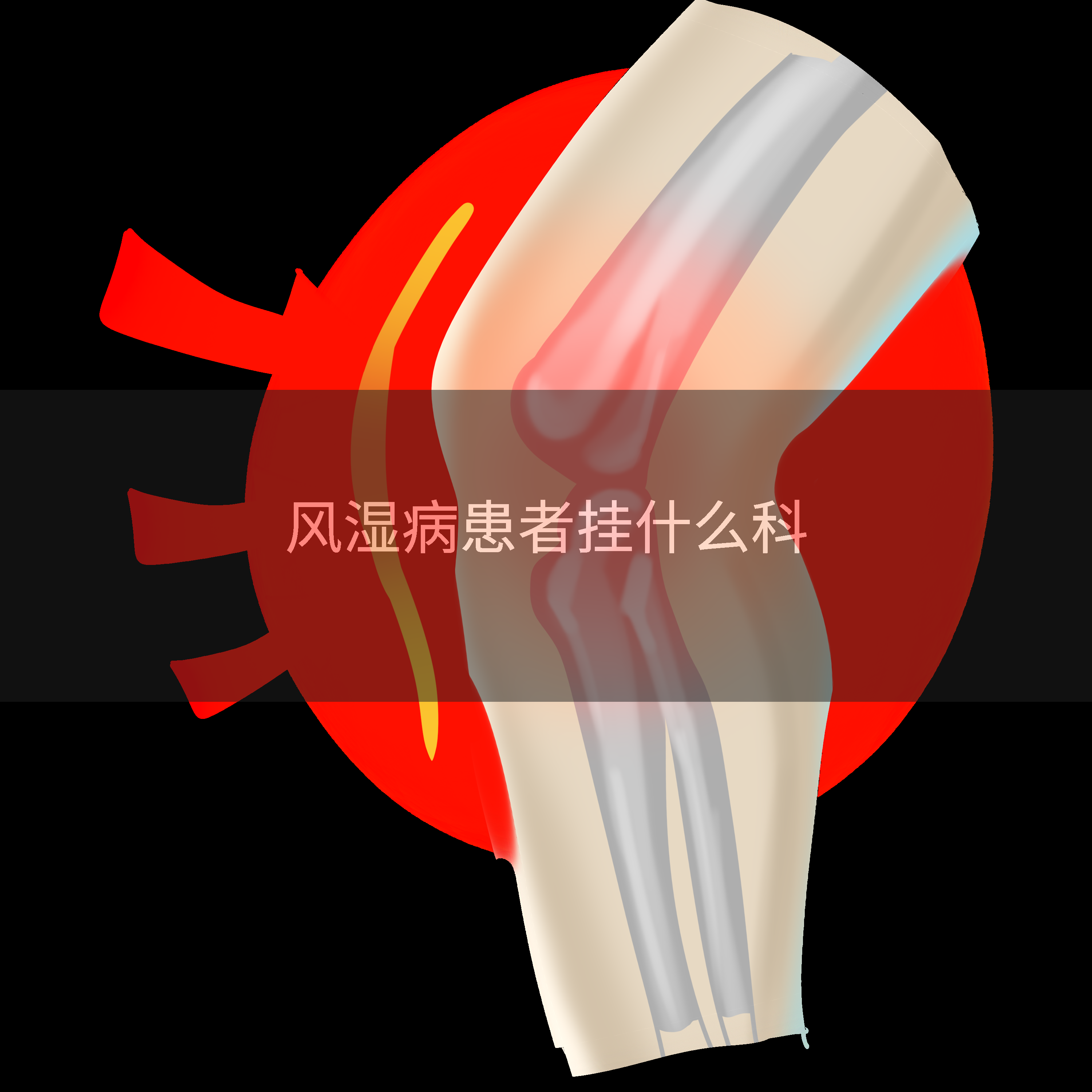 风湿病患者挂什么科