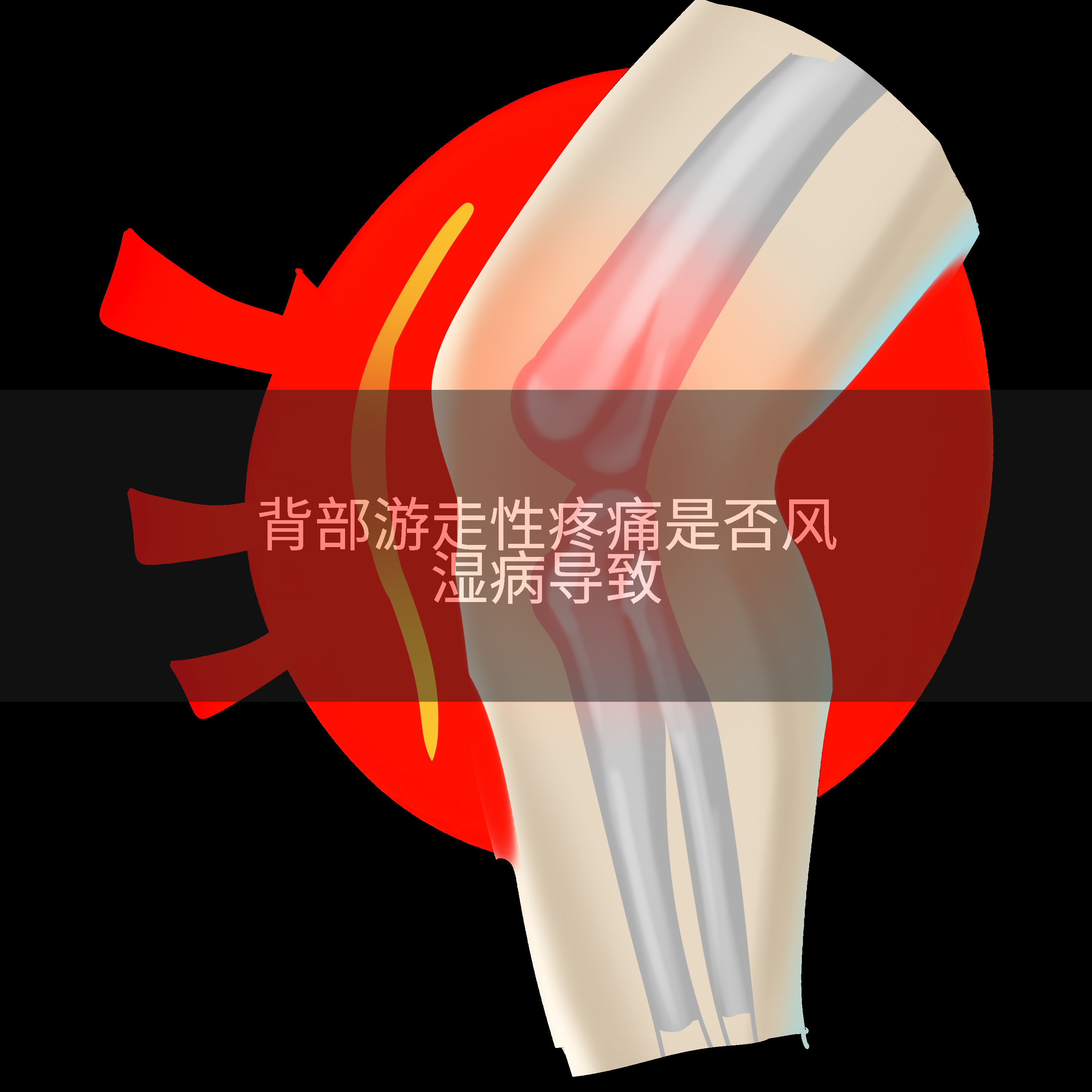 背部游走性疼痛是否风湿病导致