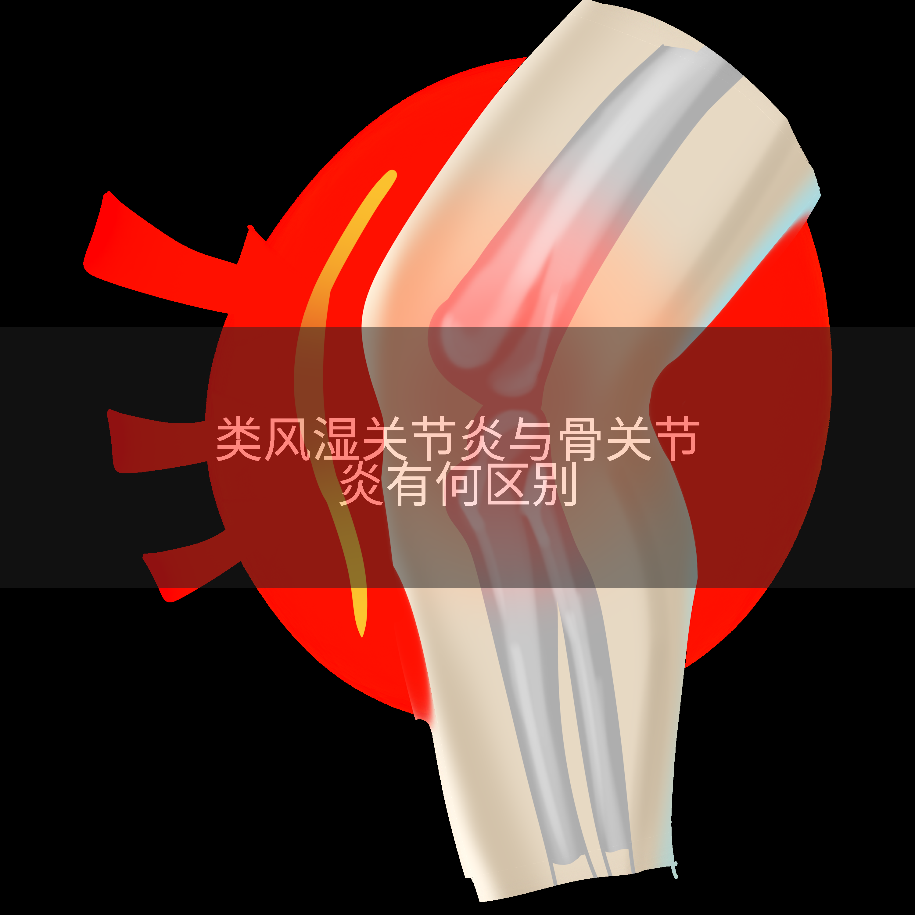 类风湿关节炎与骨关节炎有何区别