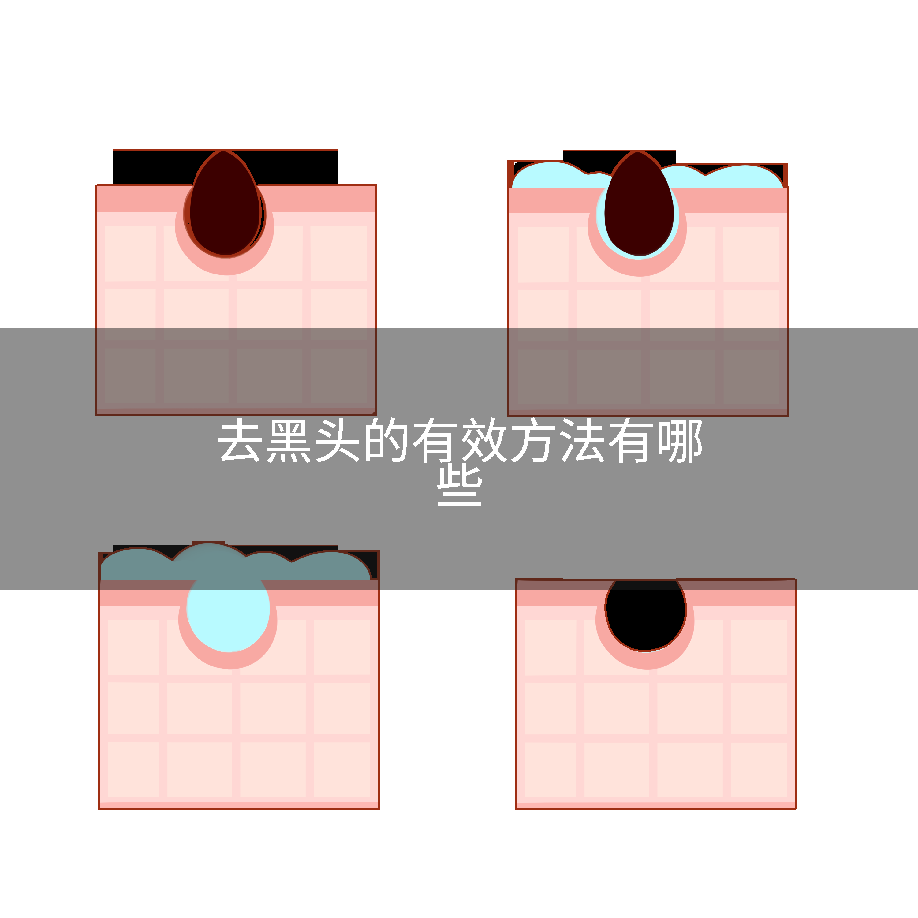 去黑头的有效方法有哪些