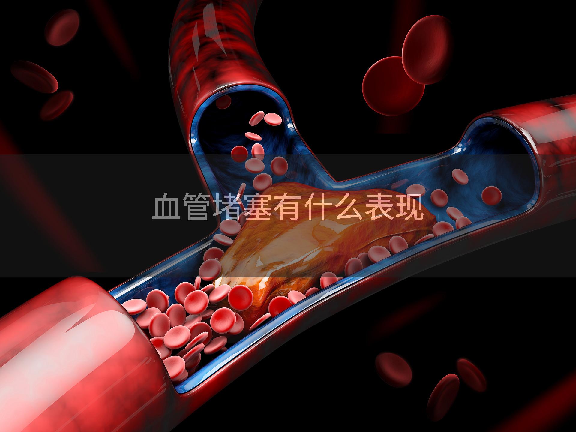 血管堵塞有什么表现