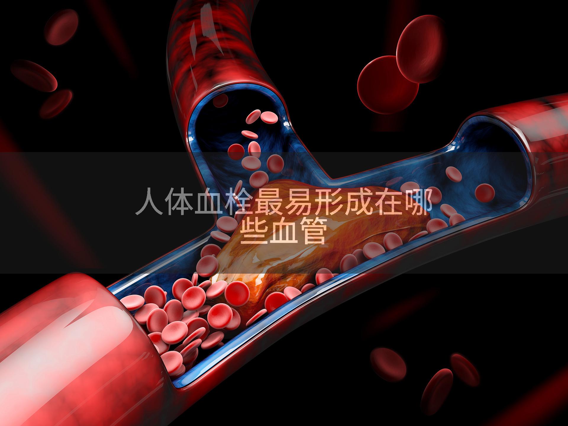 人体血栓最易形成在哪些血管