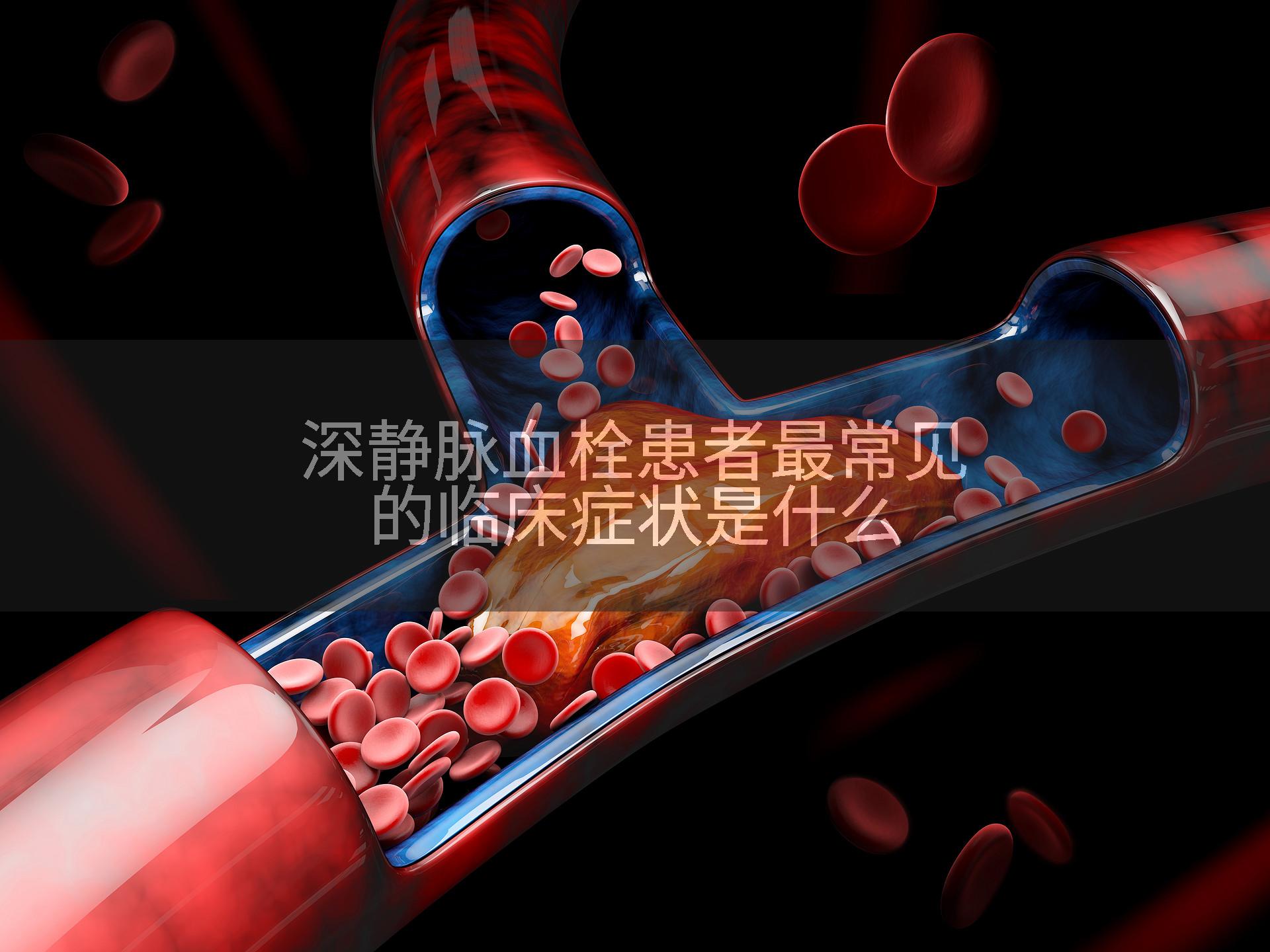 深静脉血栓患者最常见的临床症状是什么