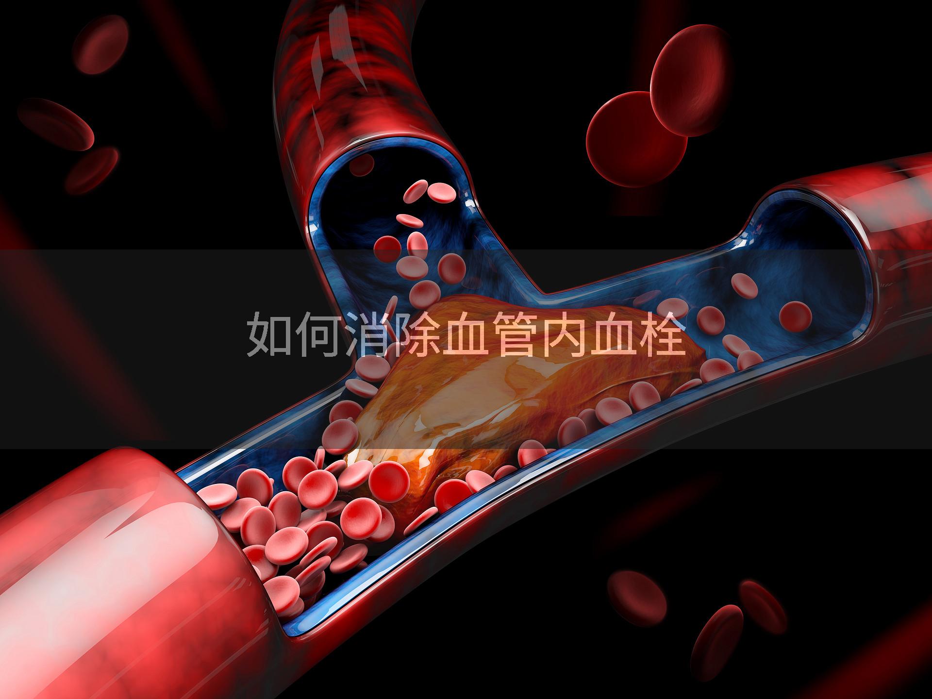 如何消除血管内血栓