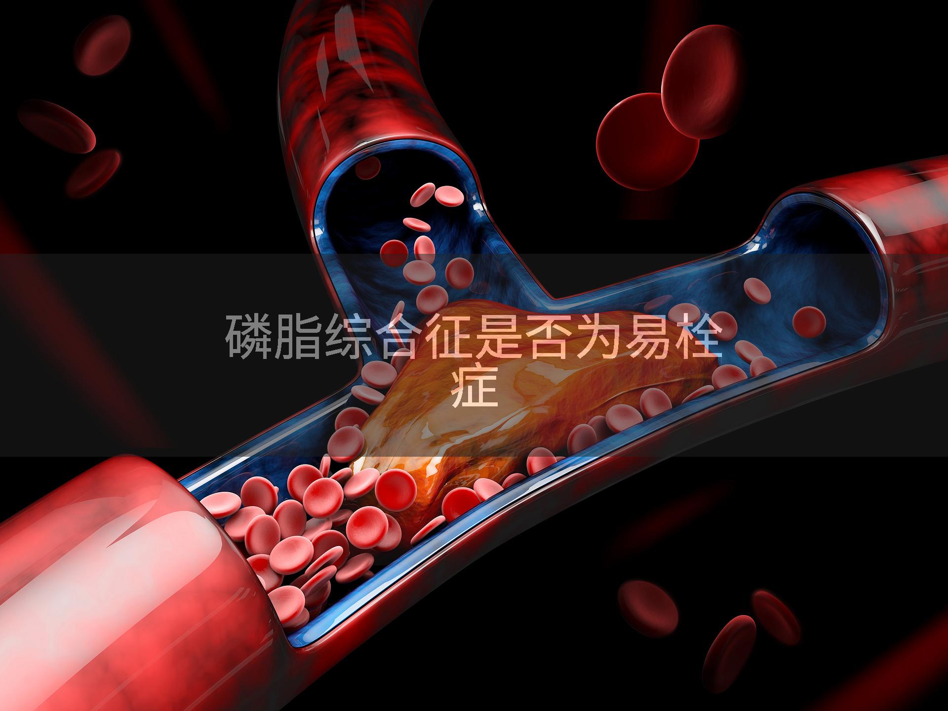 磷脂综合征是否为易栓症