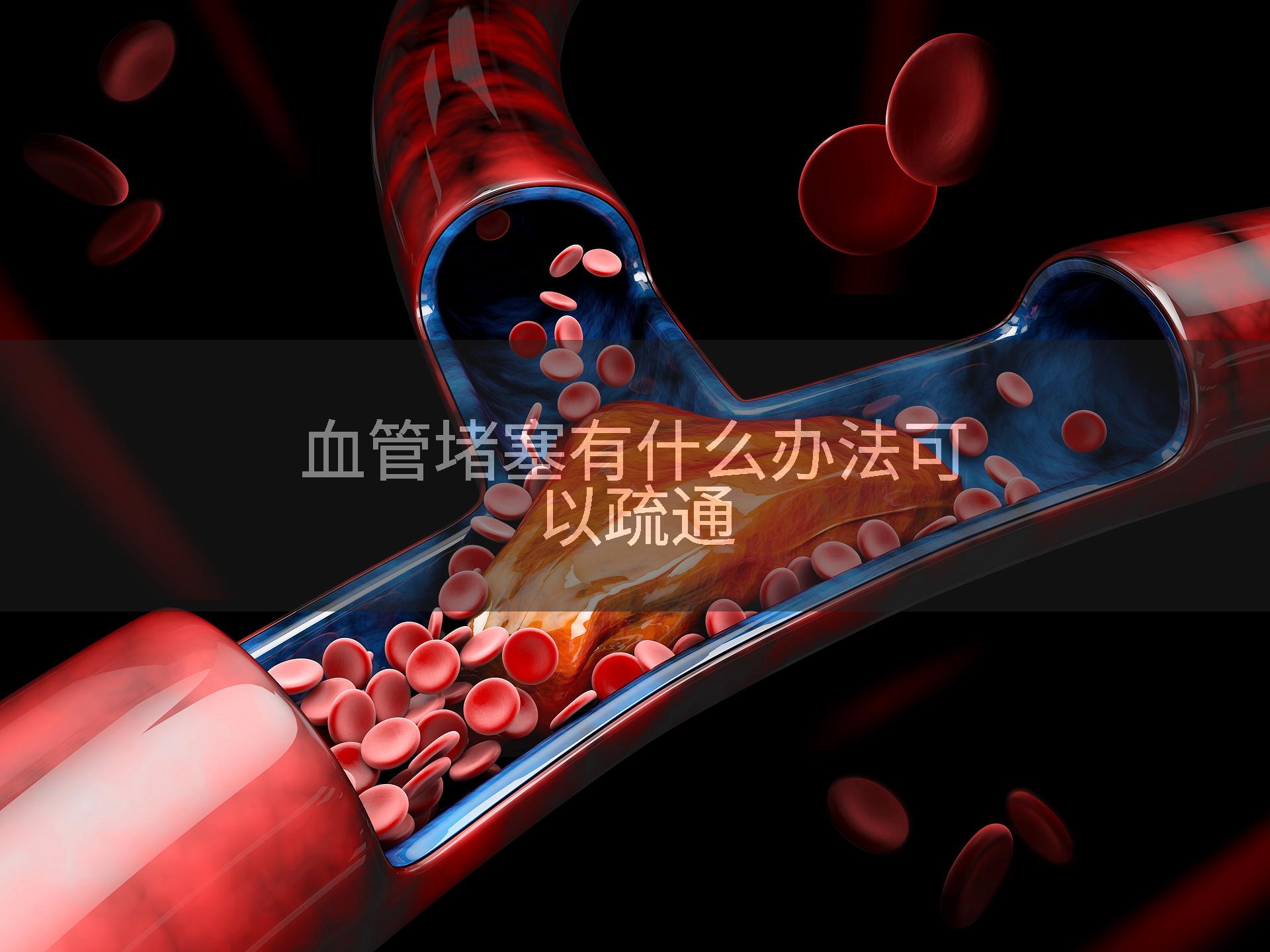 血管堵塞有什么办法可以疏通