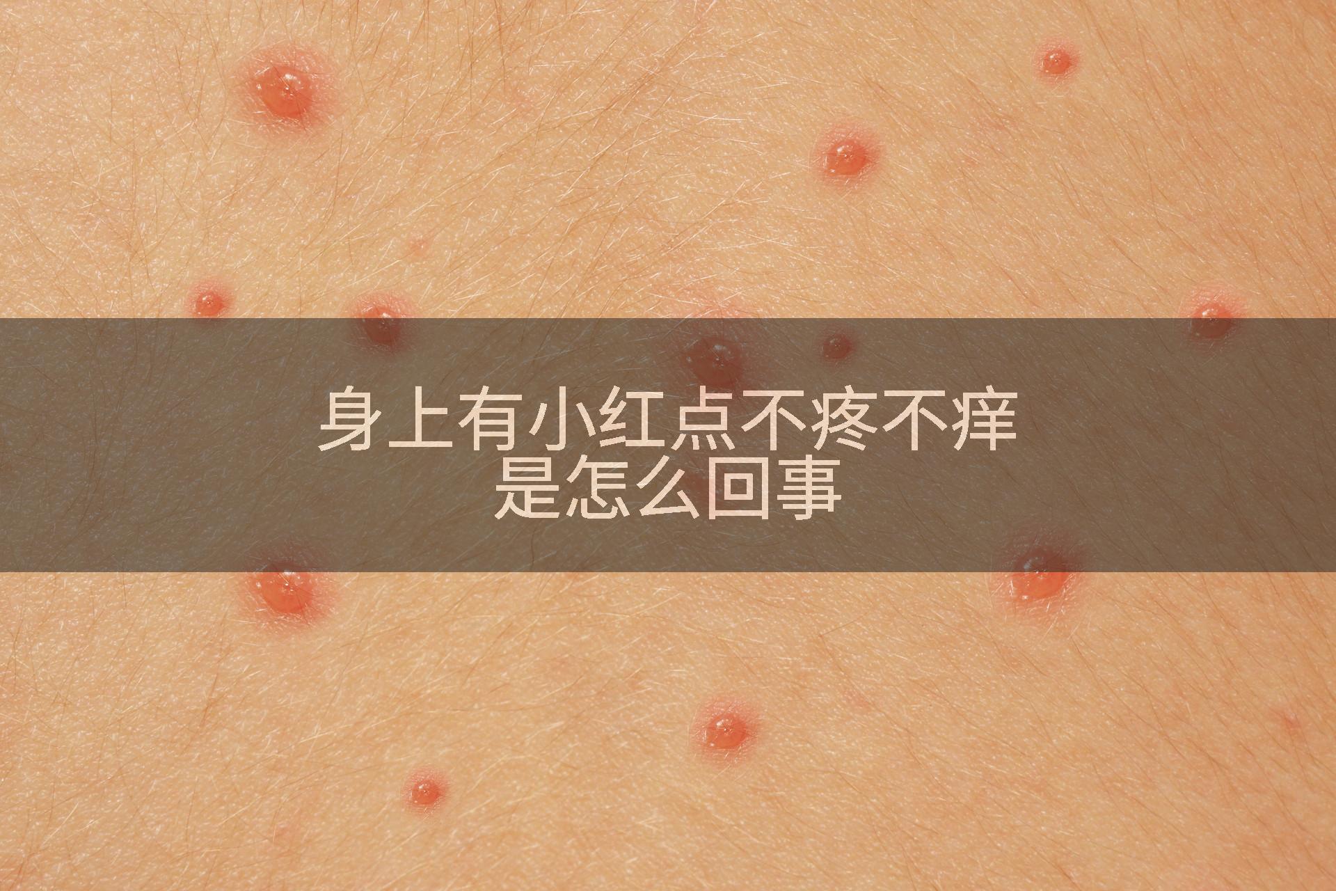 身上有小红点不疼不痒是怎么回事