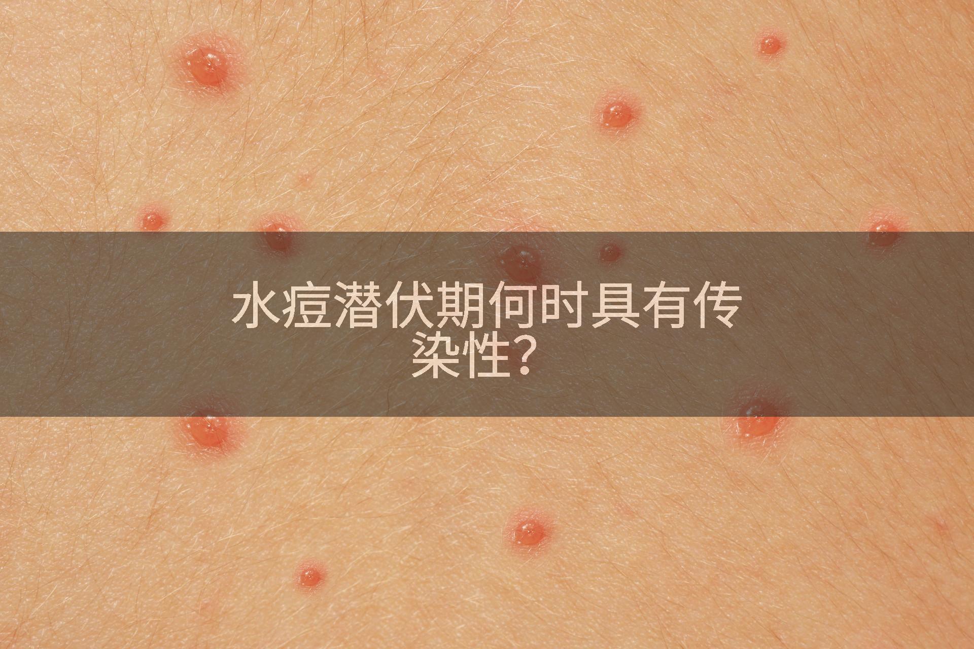 水痘潜伏期何时具有传染性？