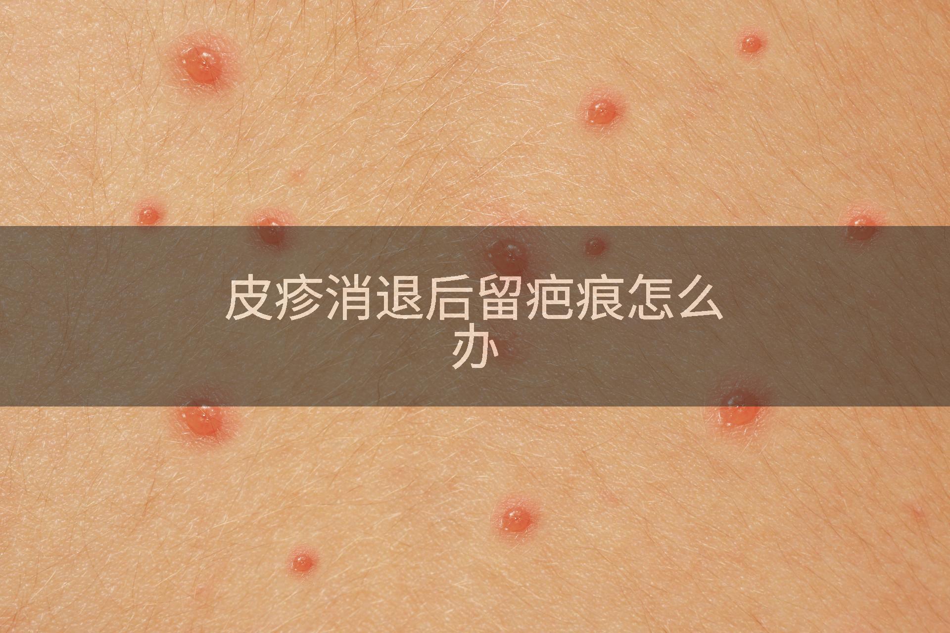 皮疹消退后留疤痕怎么办