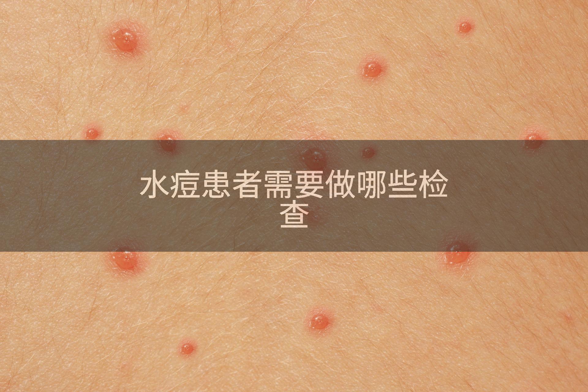 水痘患者需要做哪些检查