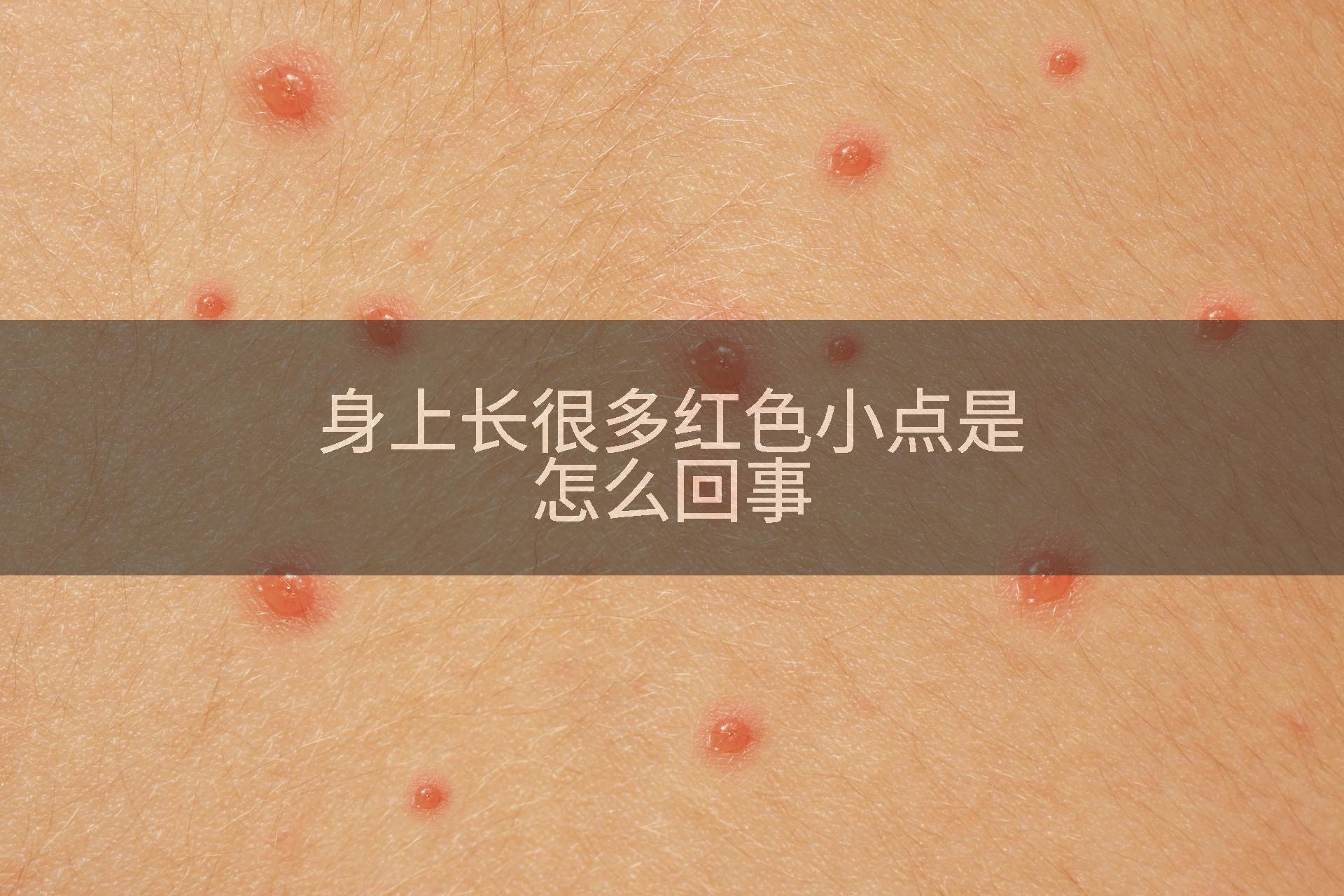 身上长很多红色小点是怎么回事