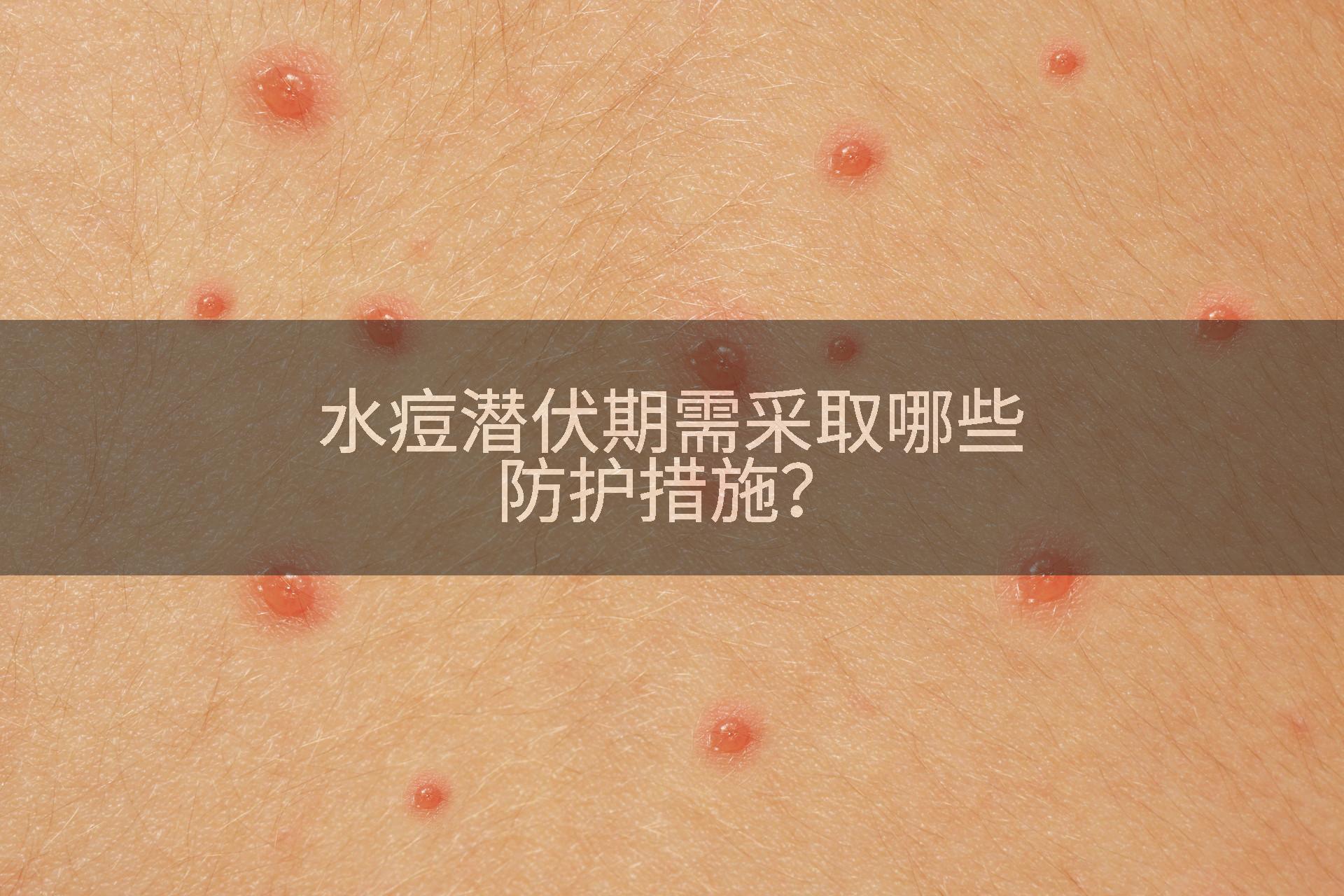 水痘潜伏期需采取哪些防护措施？