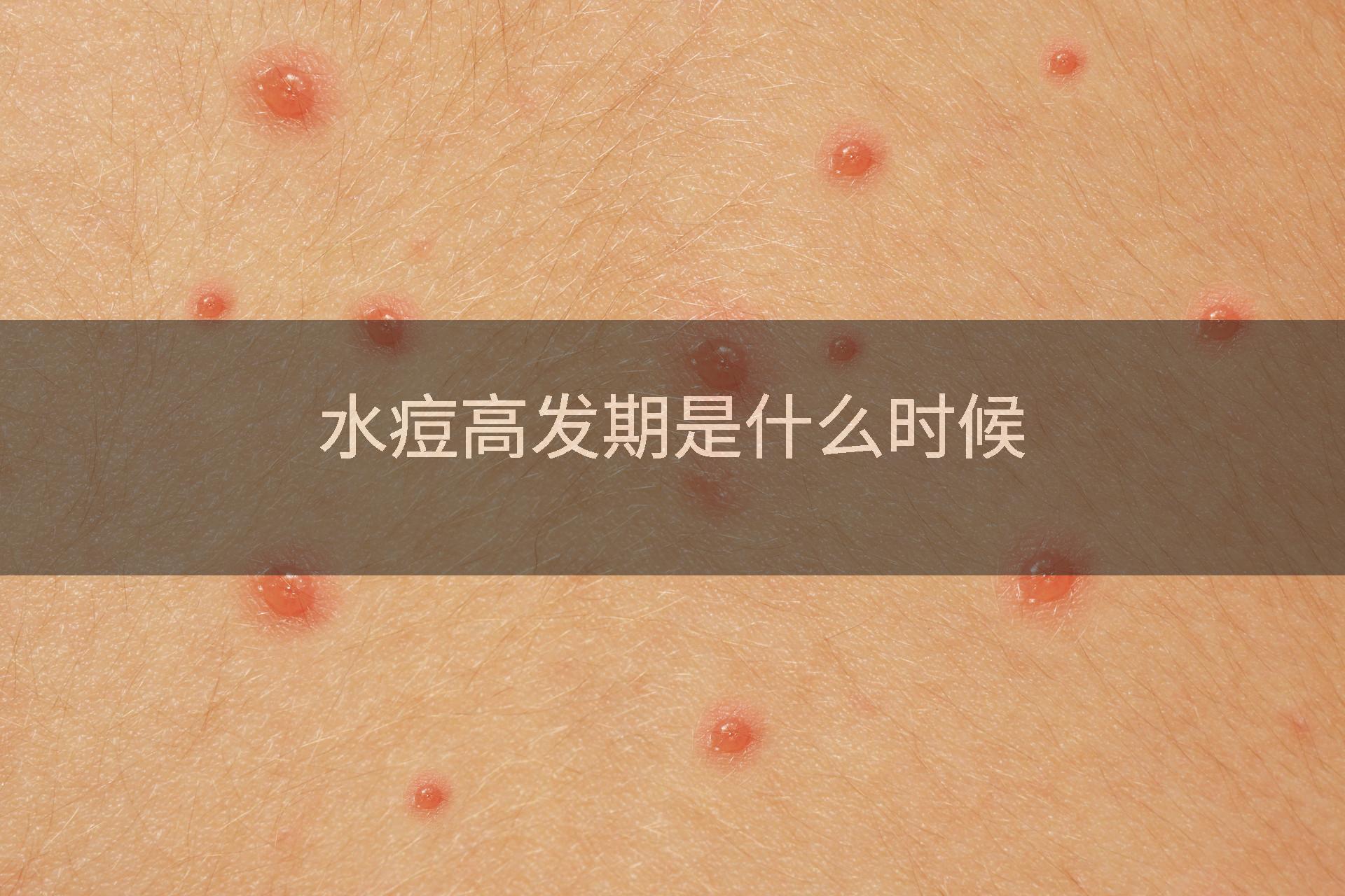 水痘高发期是什么时候