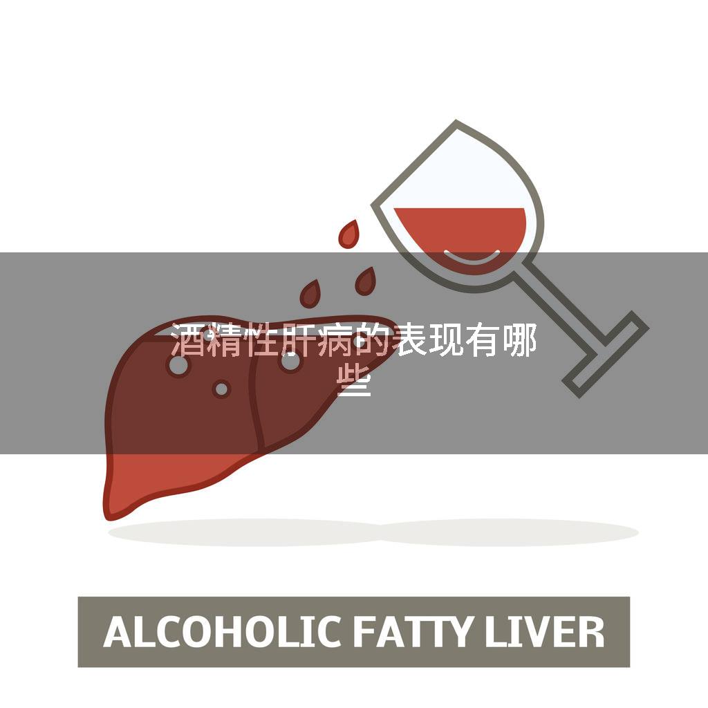 酒精性肝病的表现有哪些