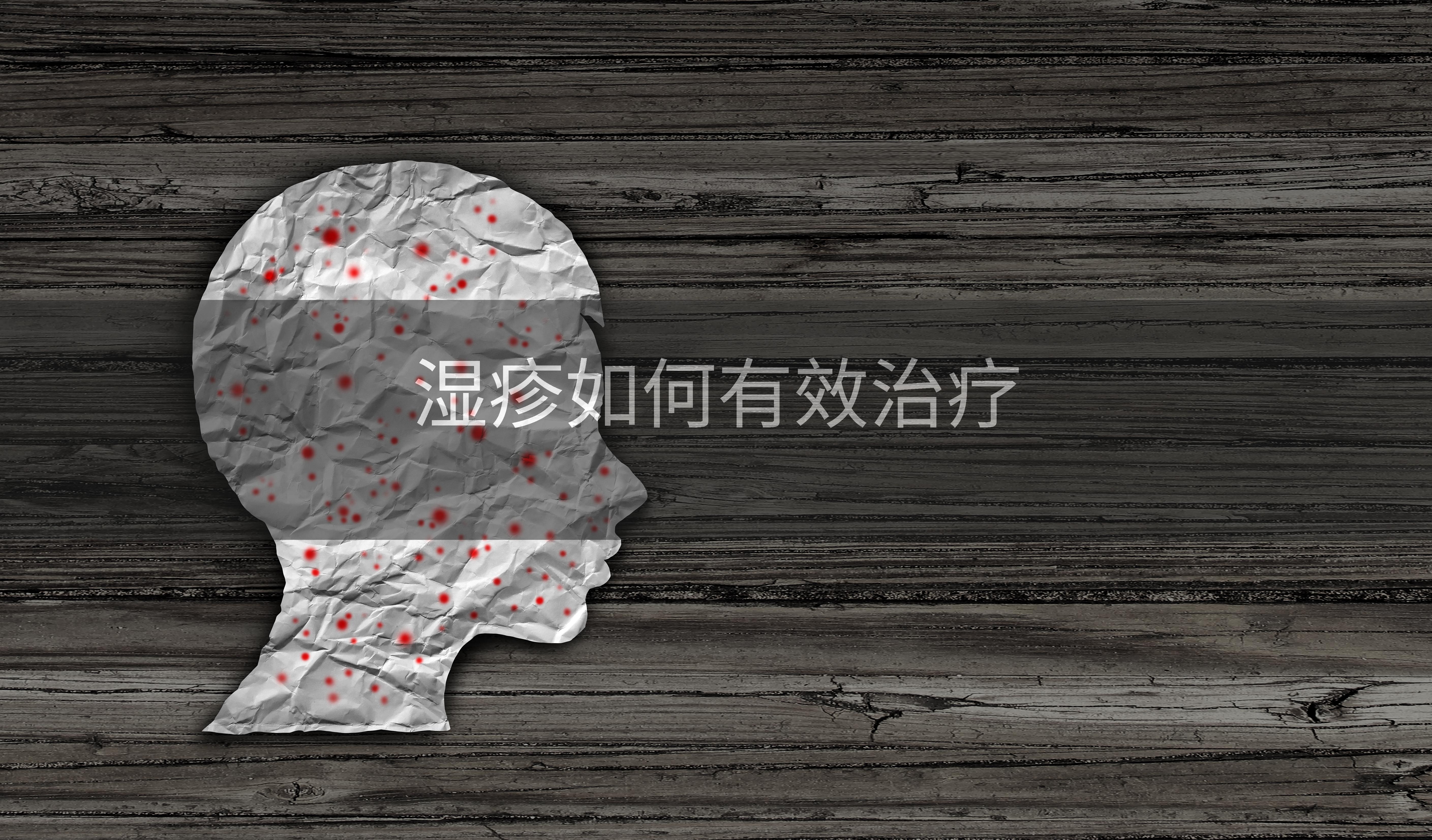 湿疹如何有效治疗