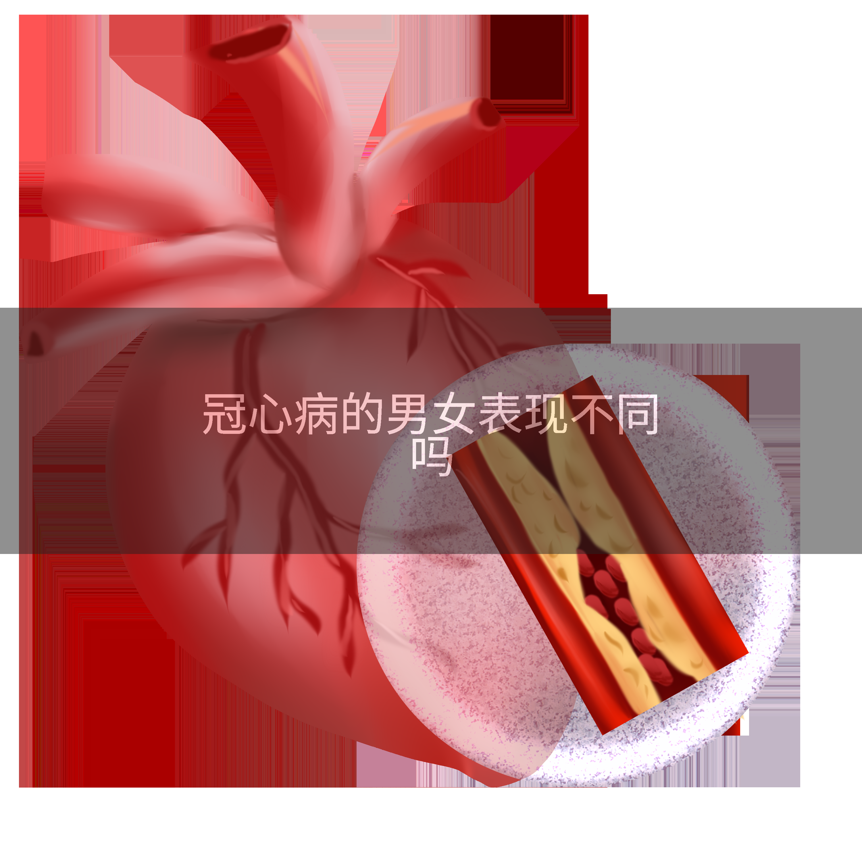 冠心病的男女表现不同吗