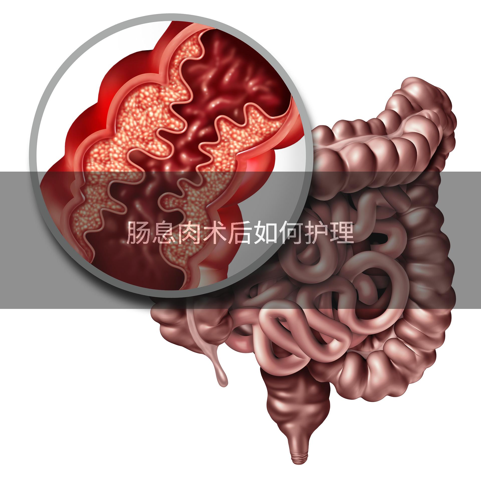 肠息肉术后如何护理