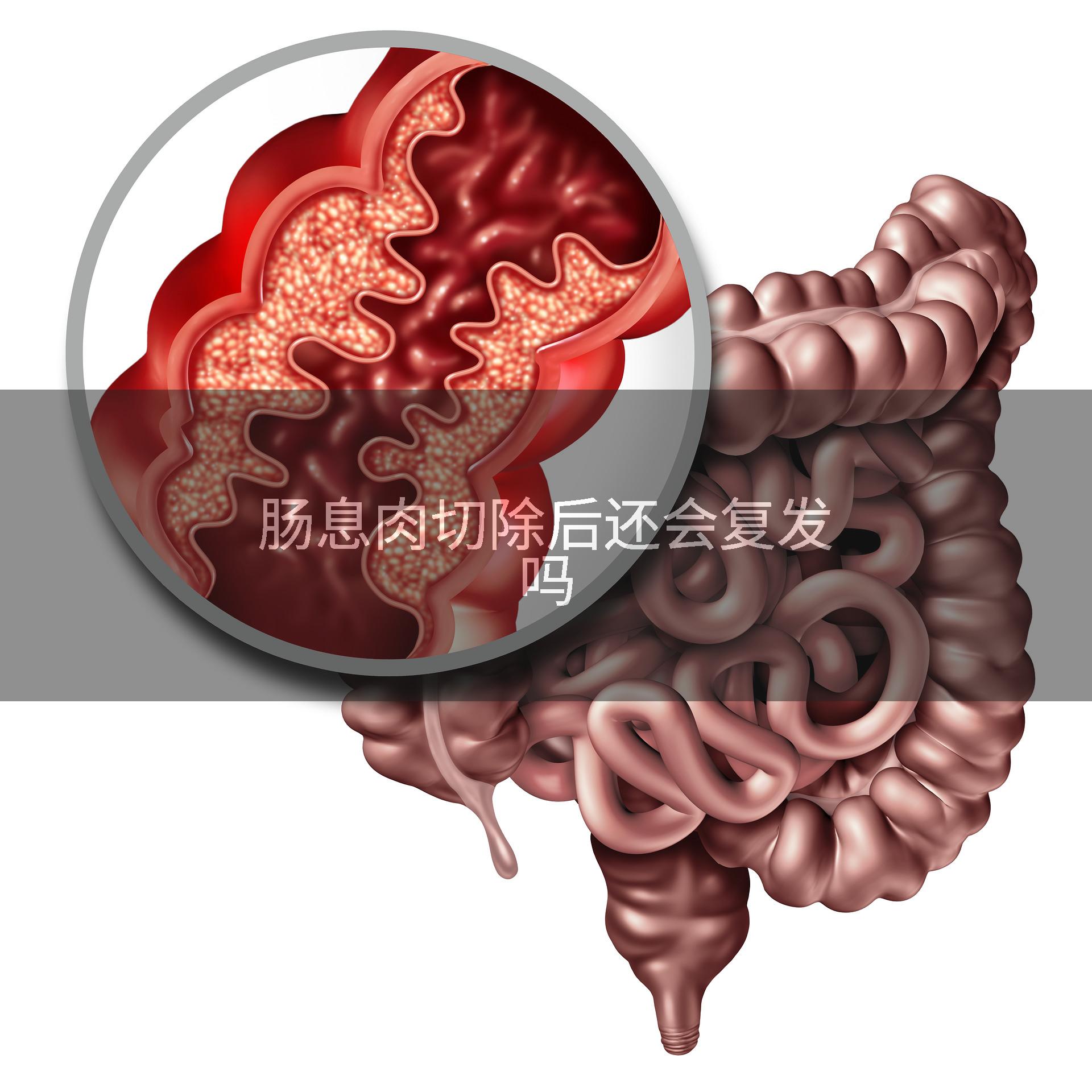 肠息肉切除后还会复发吗