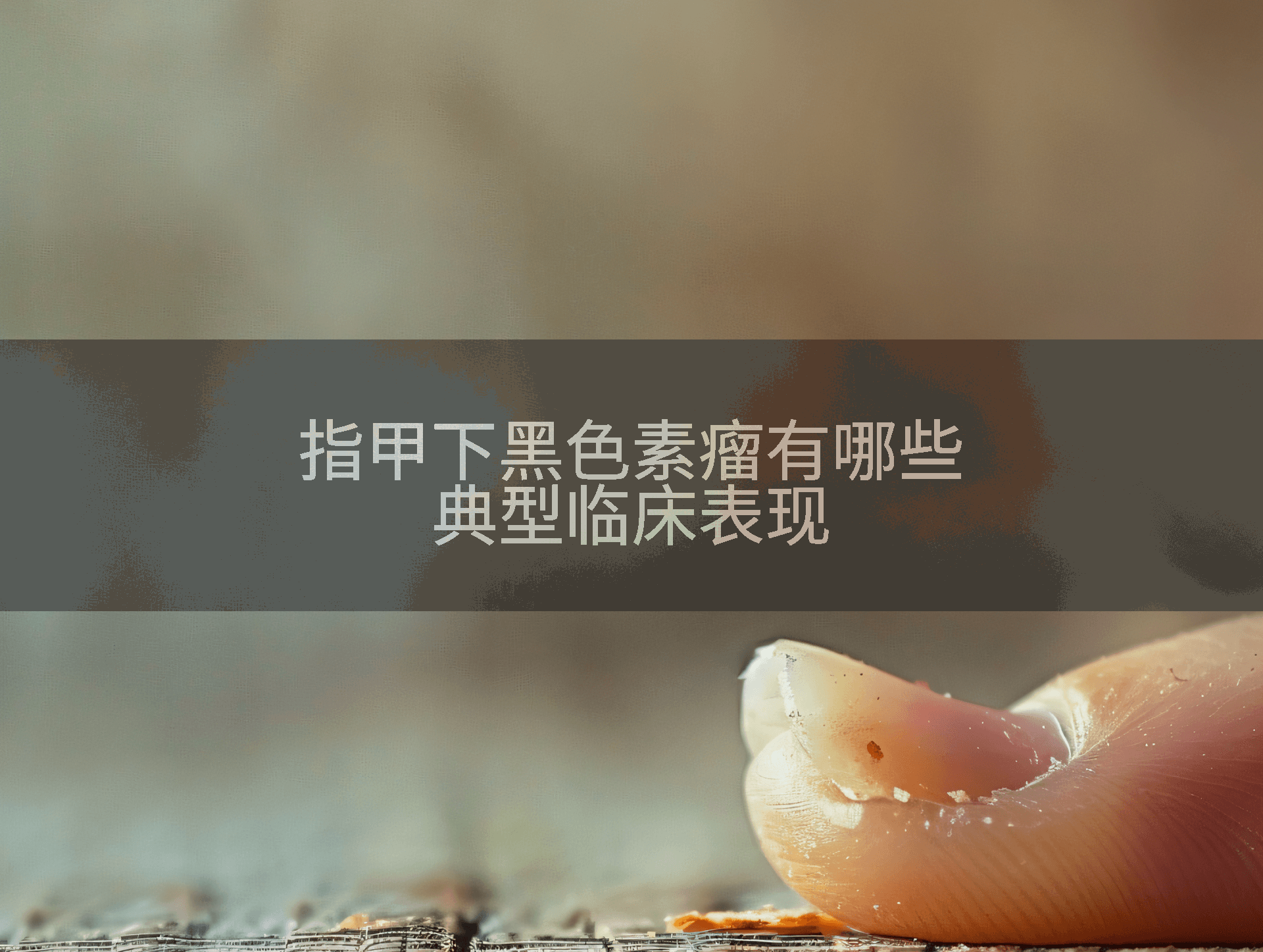 指甲下黑色素瘤有哪些典型临床表现