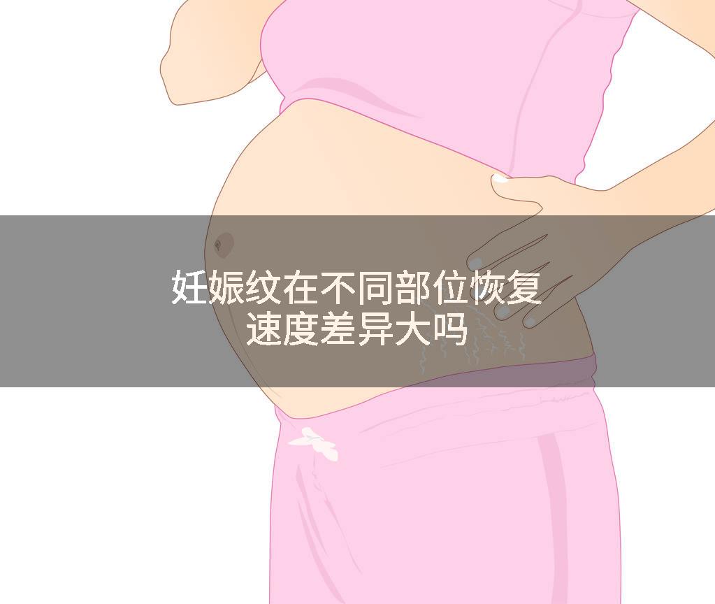 妊娠纹在不同部位恢复速度差异大吗