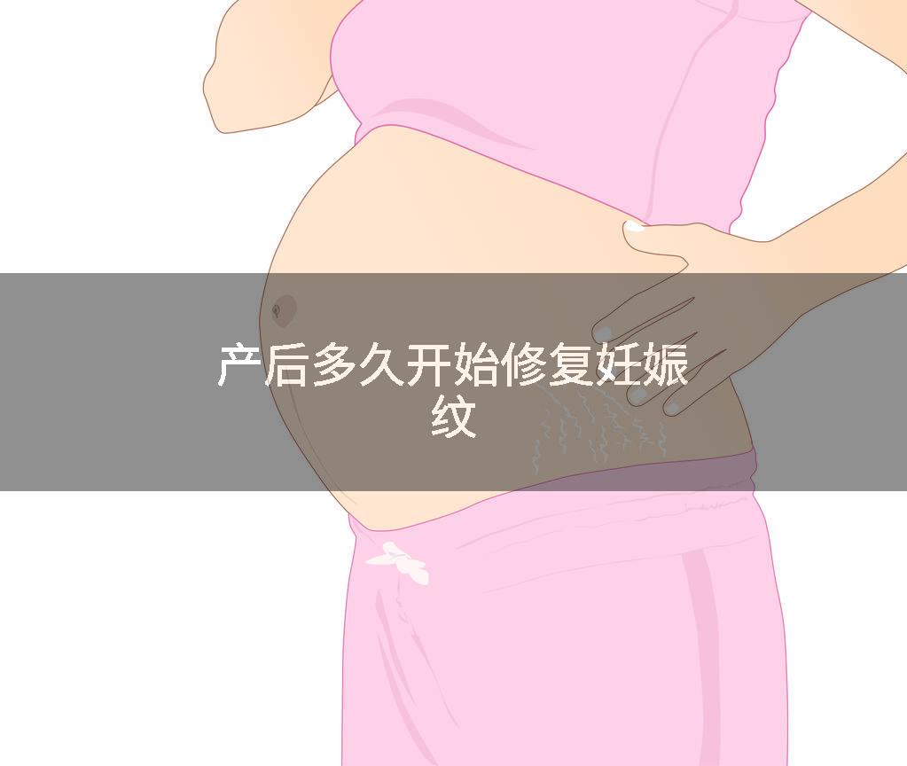 产后多久开始修复妊娠纹