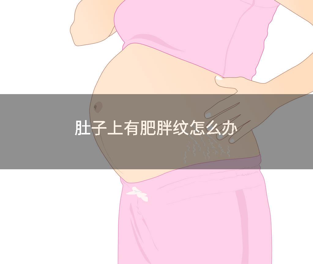 肚子上有肥胖纹怎么办