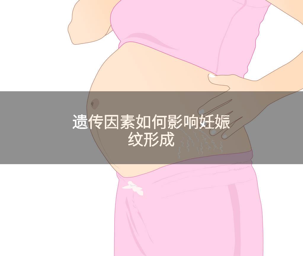 遗传因素如何影响妊娠纹形成