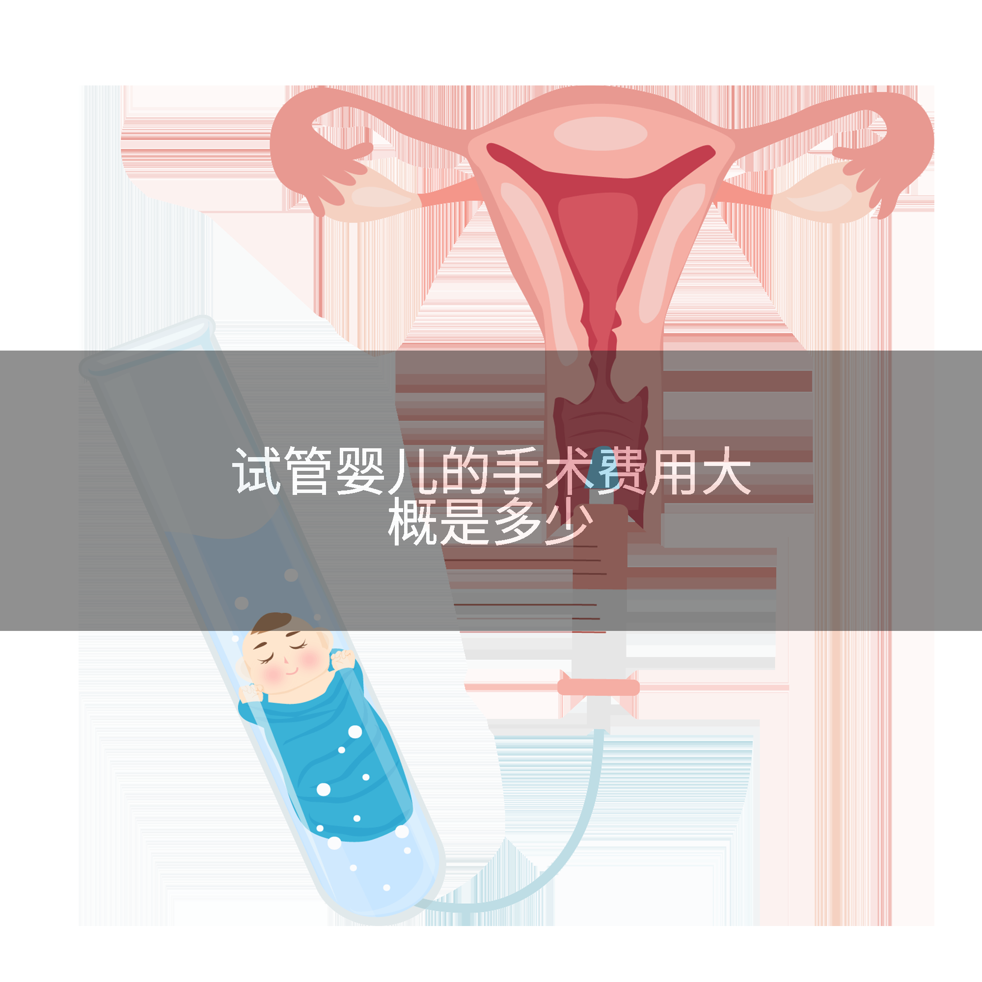 试管婴儿的手术费用大概是多少