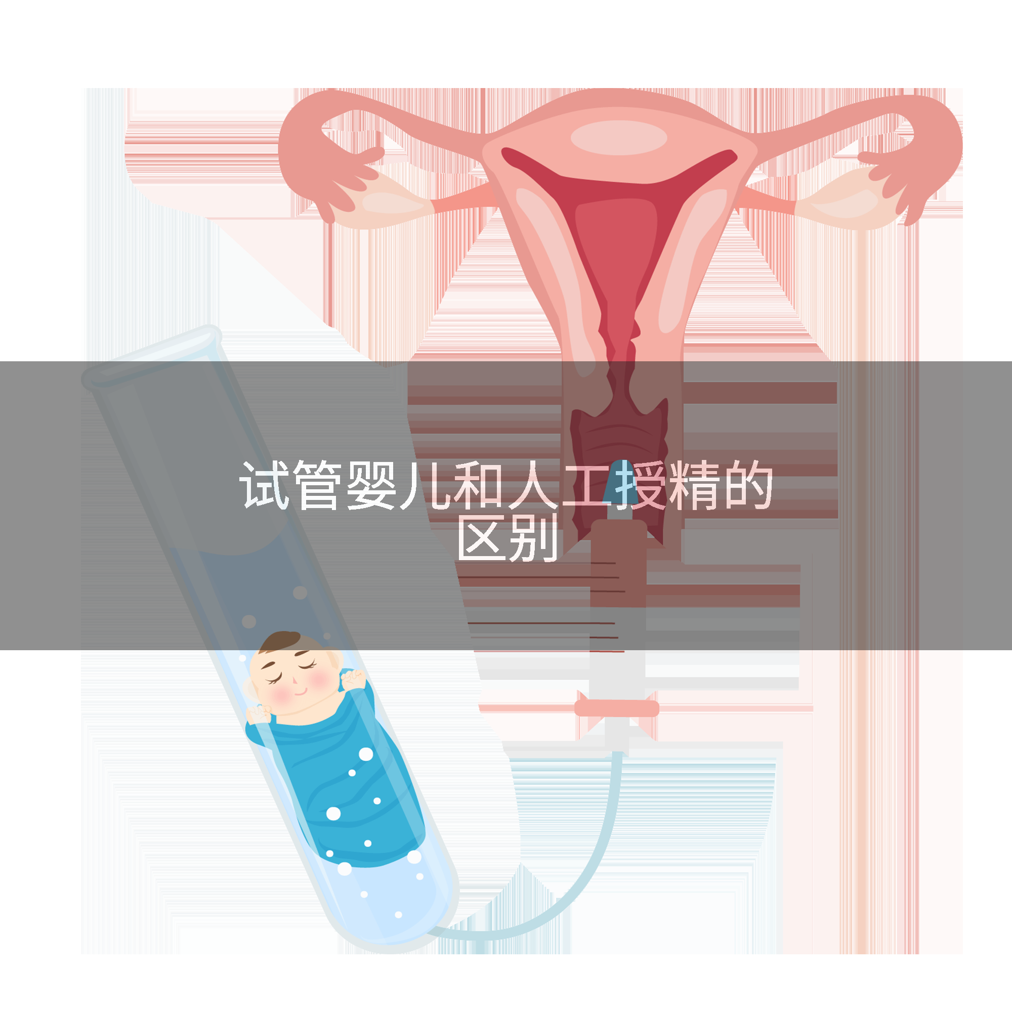 试管婴儿和人工授精的区别