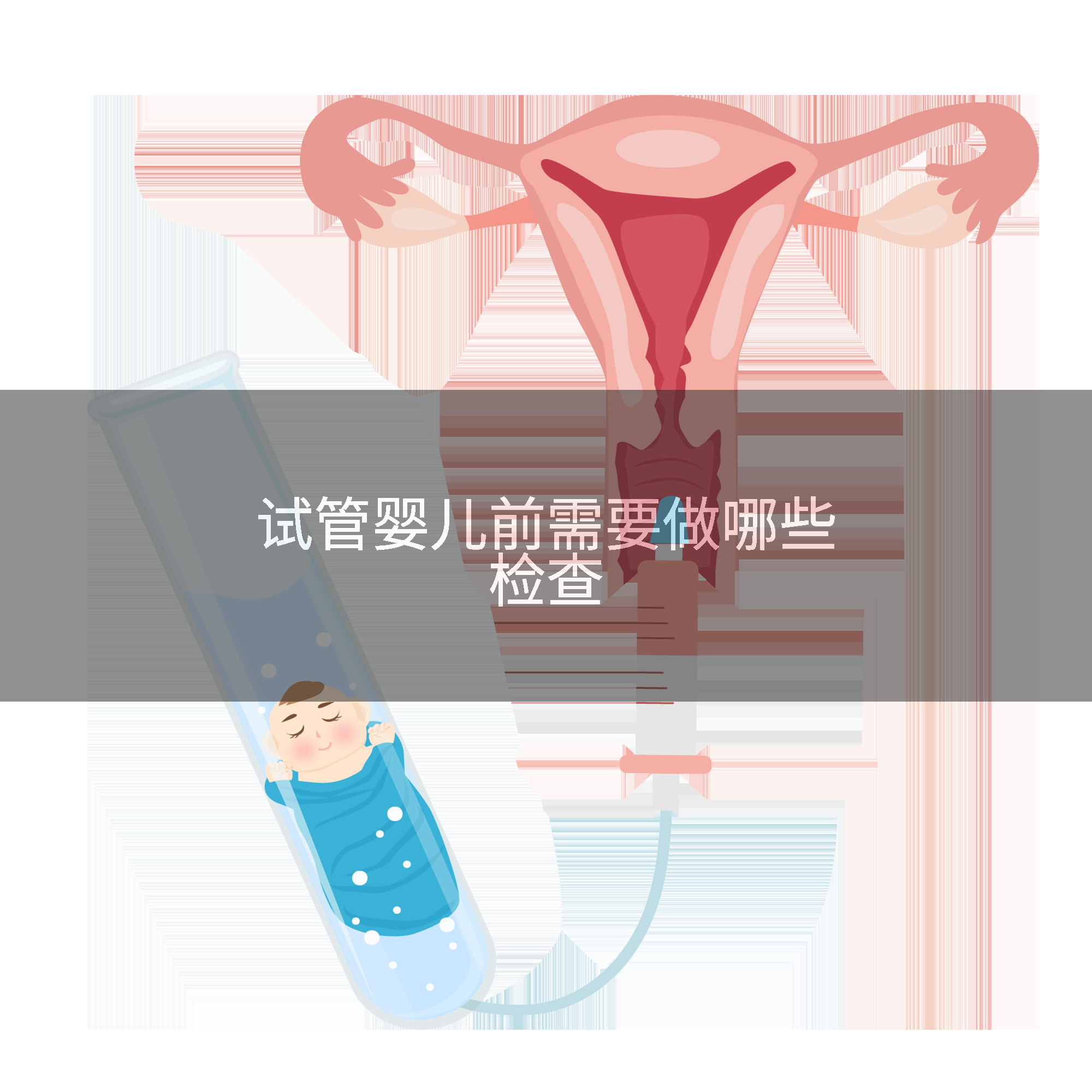 试管婴儿前需要做哪些检查