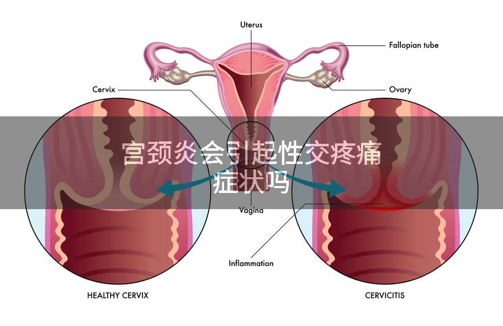 宫颈炎会引起性交疼痛症状吗