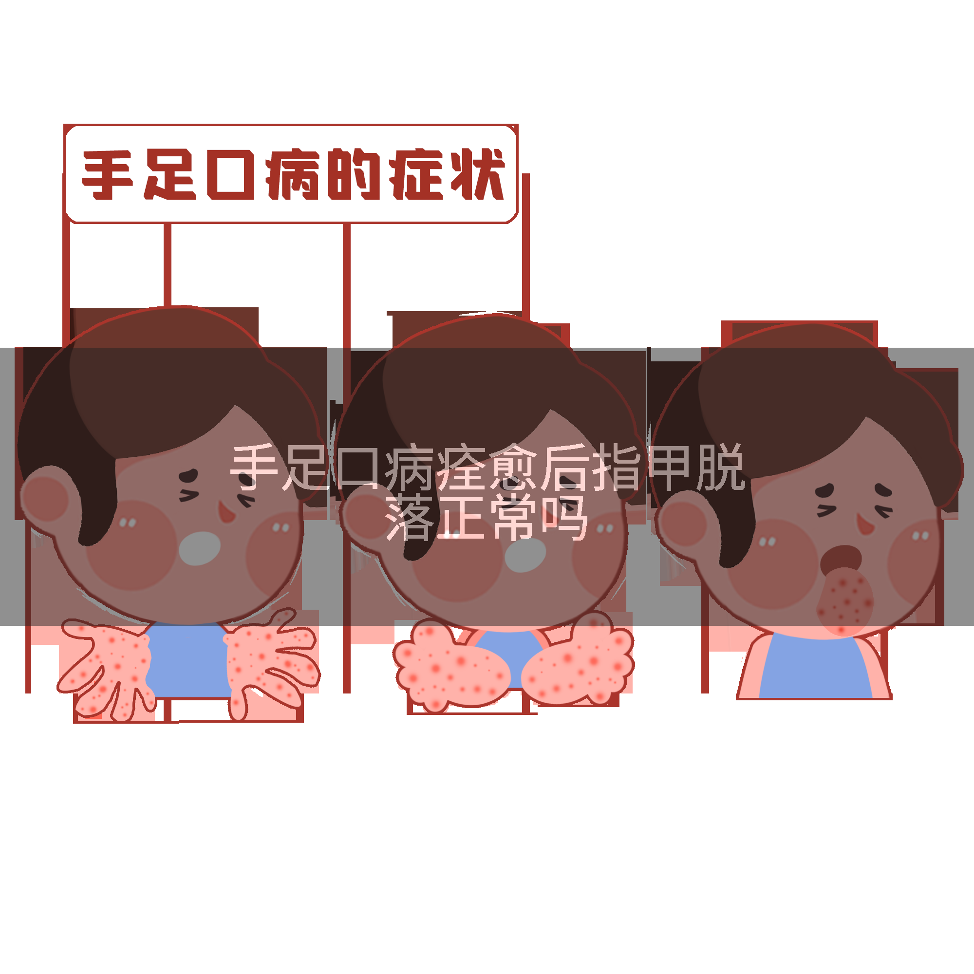手足口病痊愈后指甲脱落正常吗