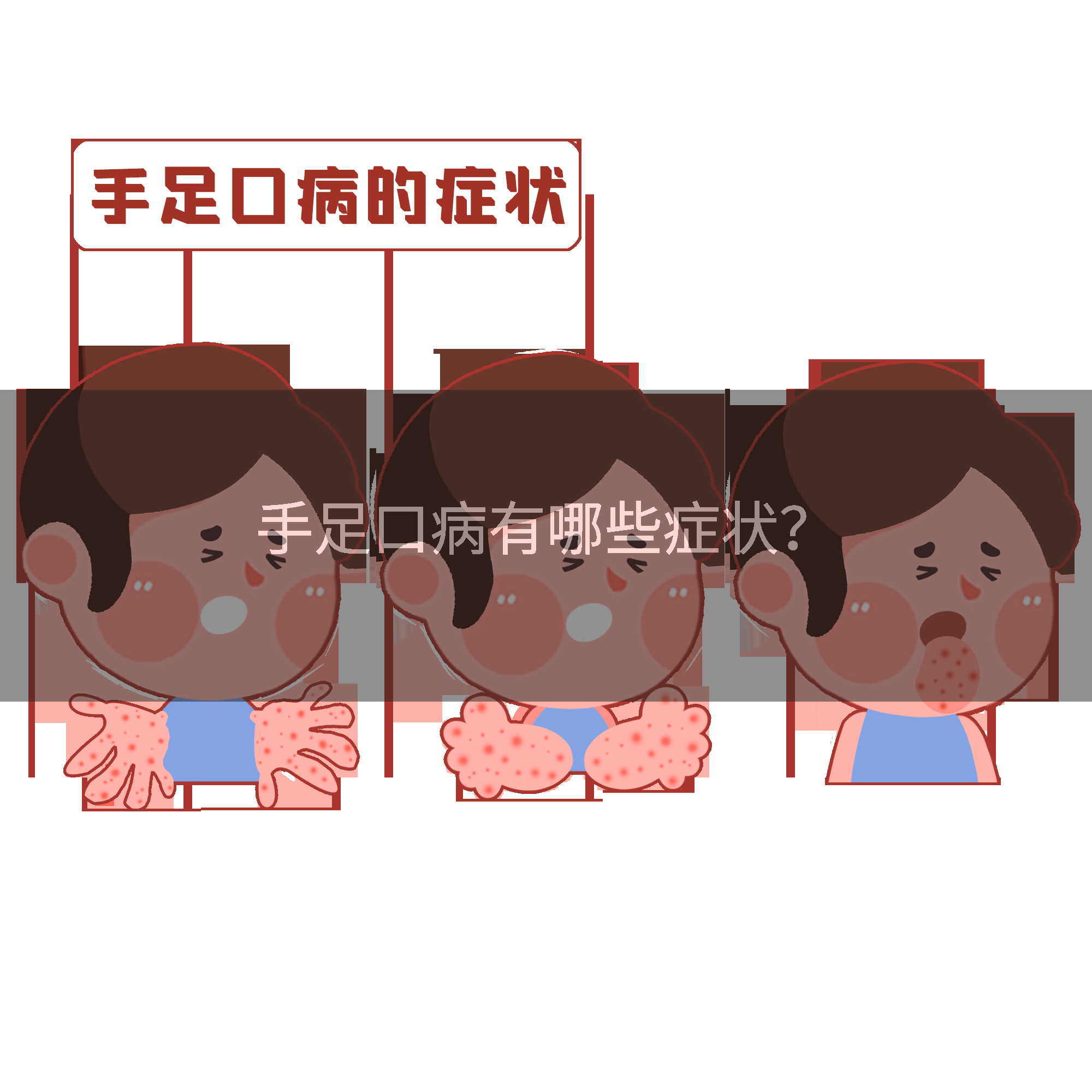 手足口病有哪些症状?