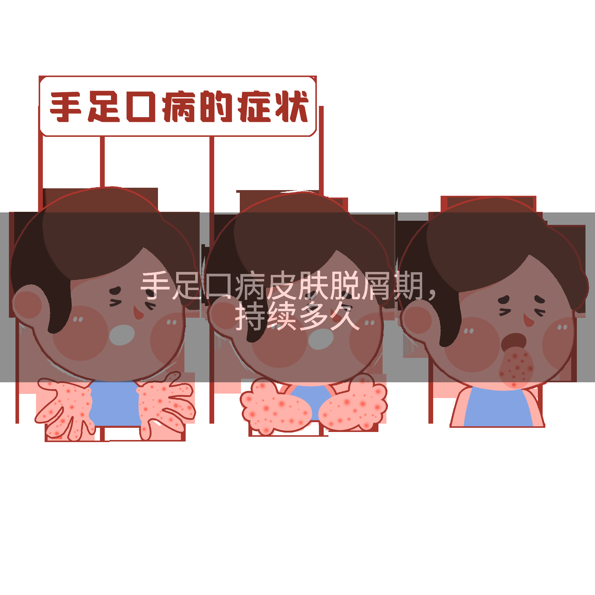 手足口病皮肤脱屑期,持续多久