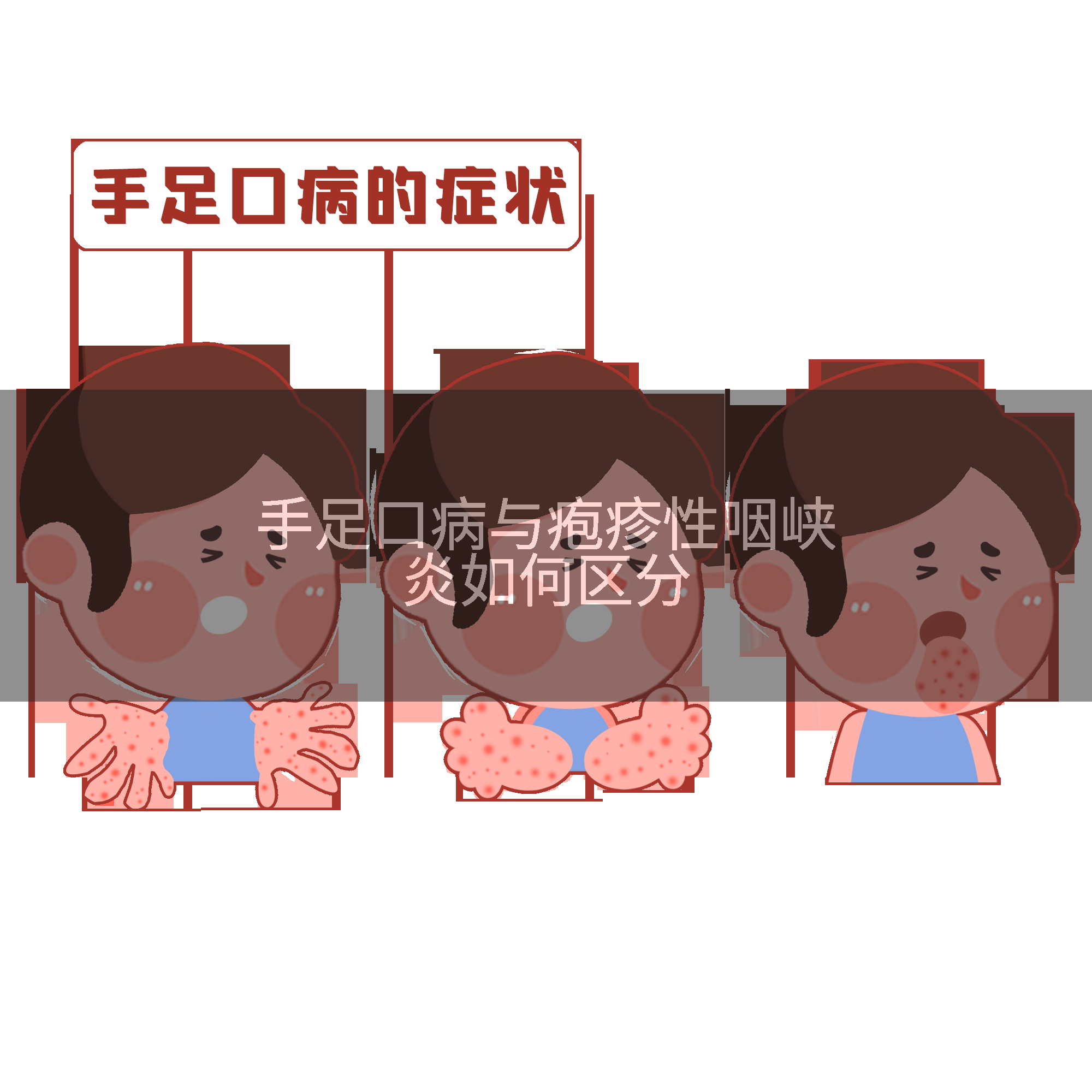 手足口病与疱疹性咽峡炎如何区分