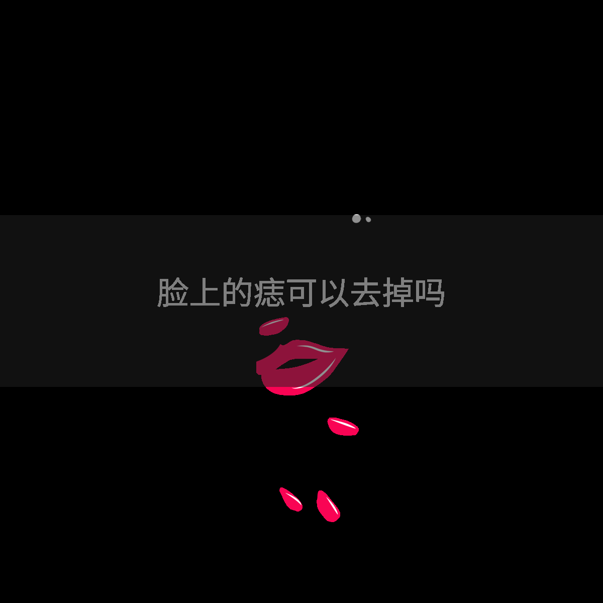 脸上的痣可以去掉吗