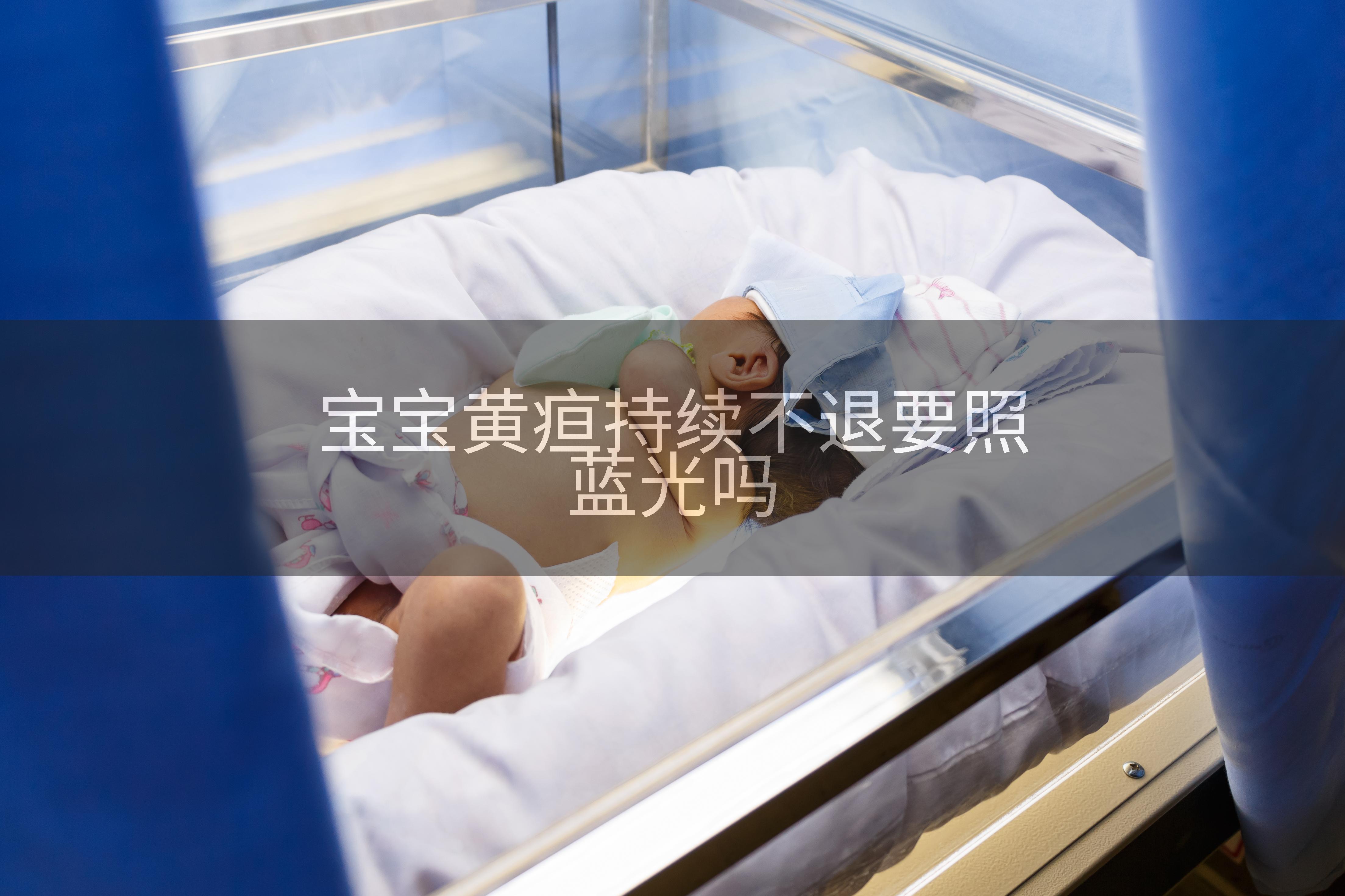 宝宝黄疸持续不退要照蓝光吗