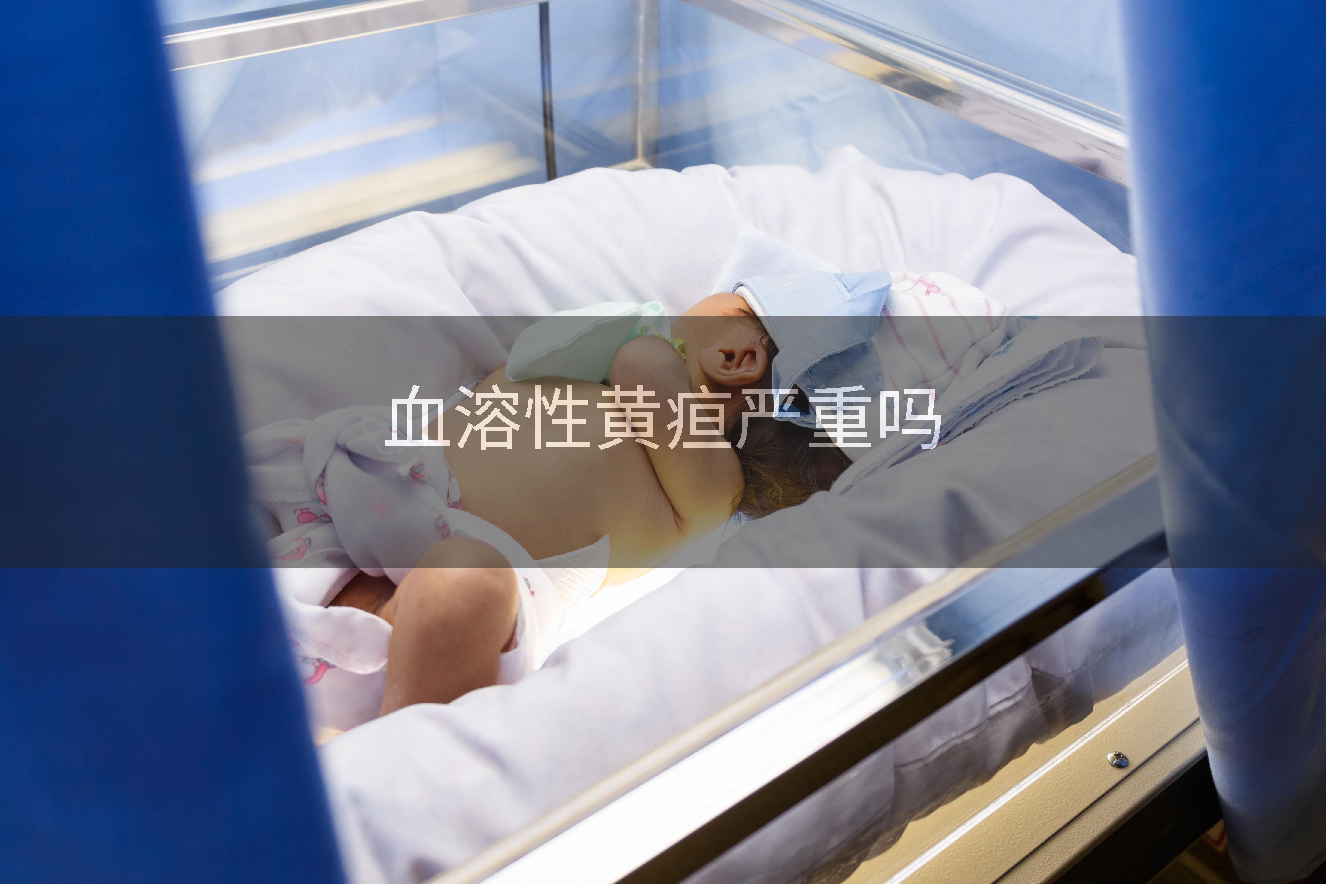 血溶性黄疸严重吗