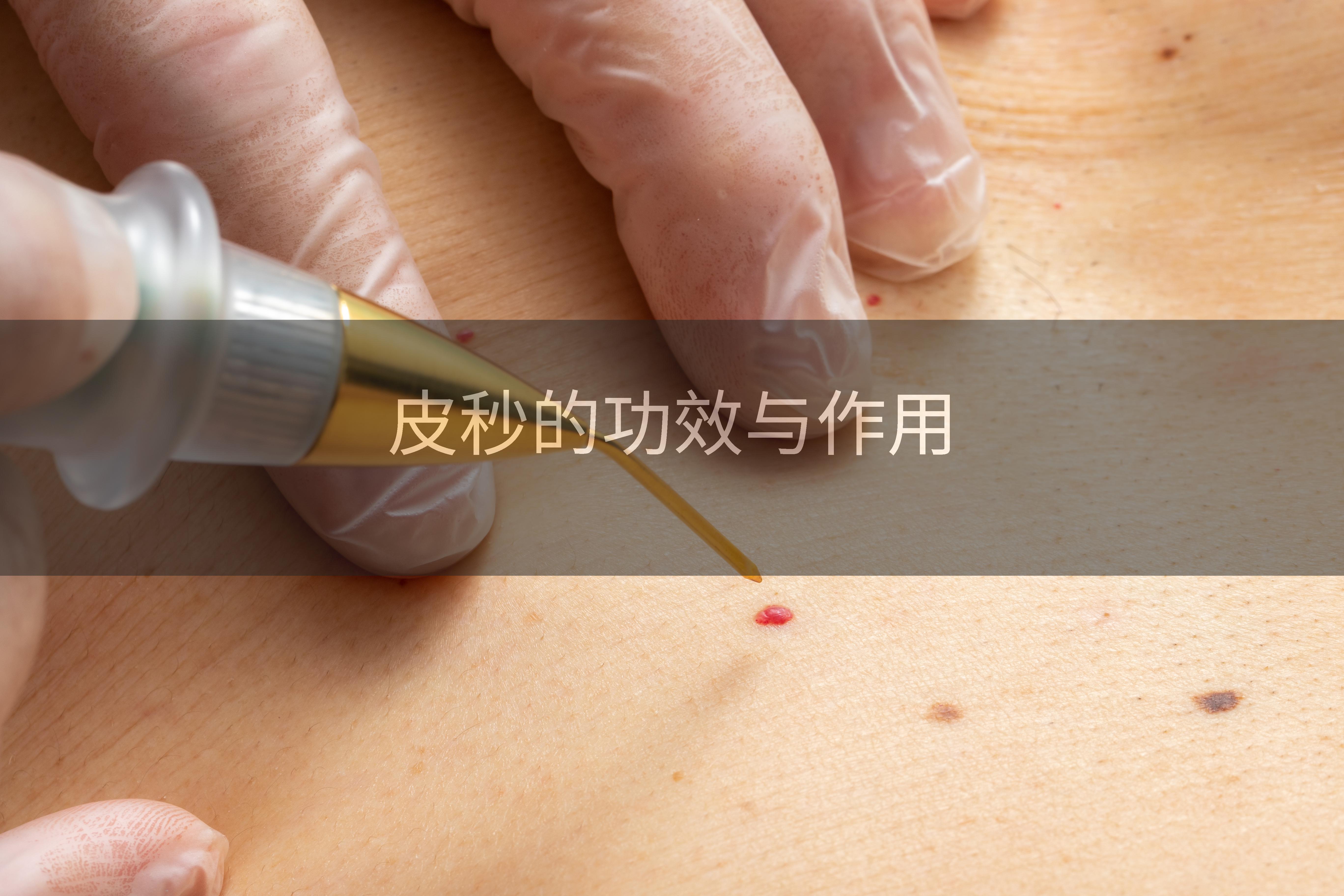 皮秒的功效与作用