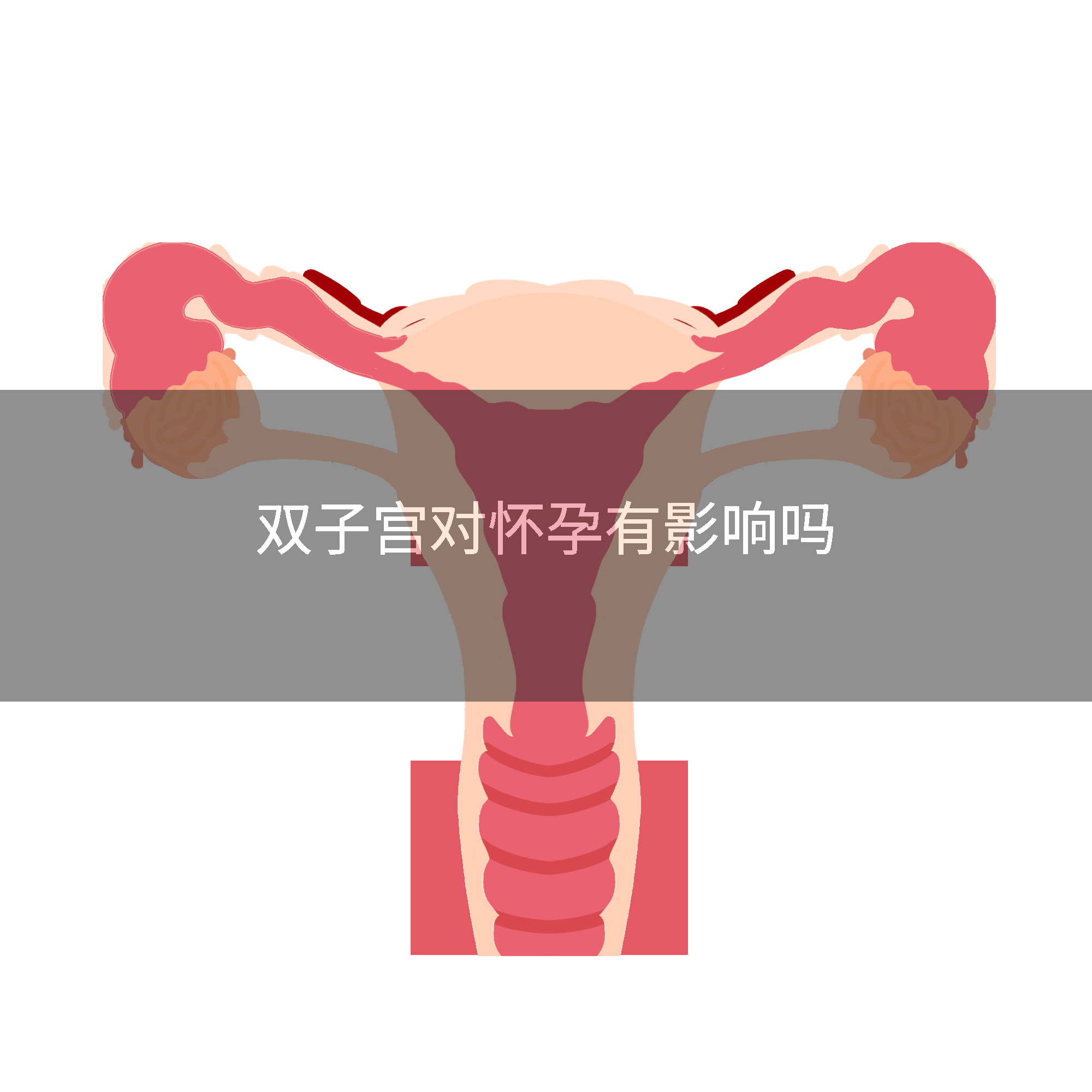 双子宫对怀孕有影响吗