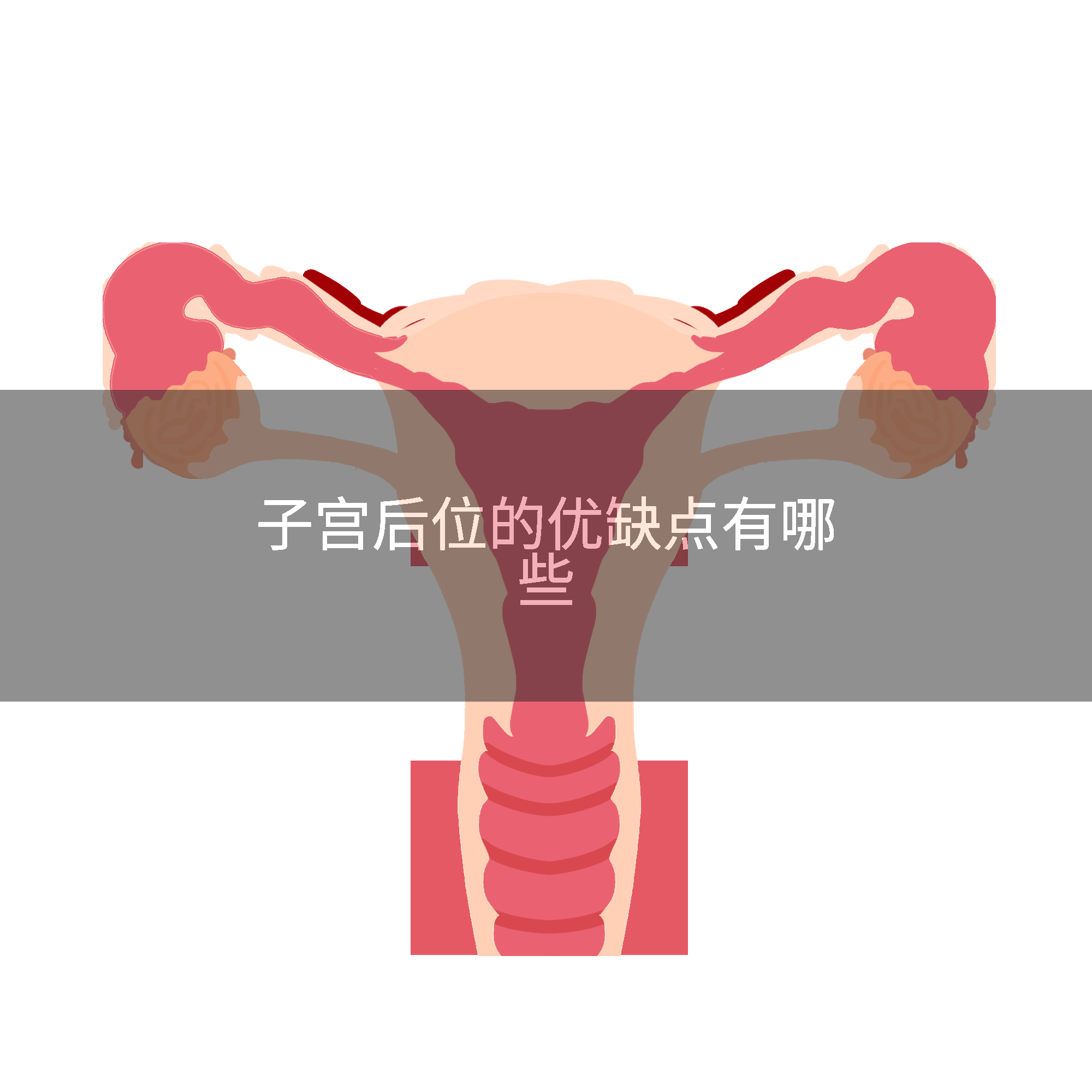 子宫后位的优缺点有哪些