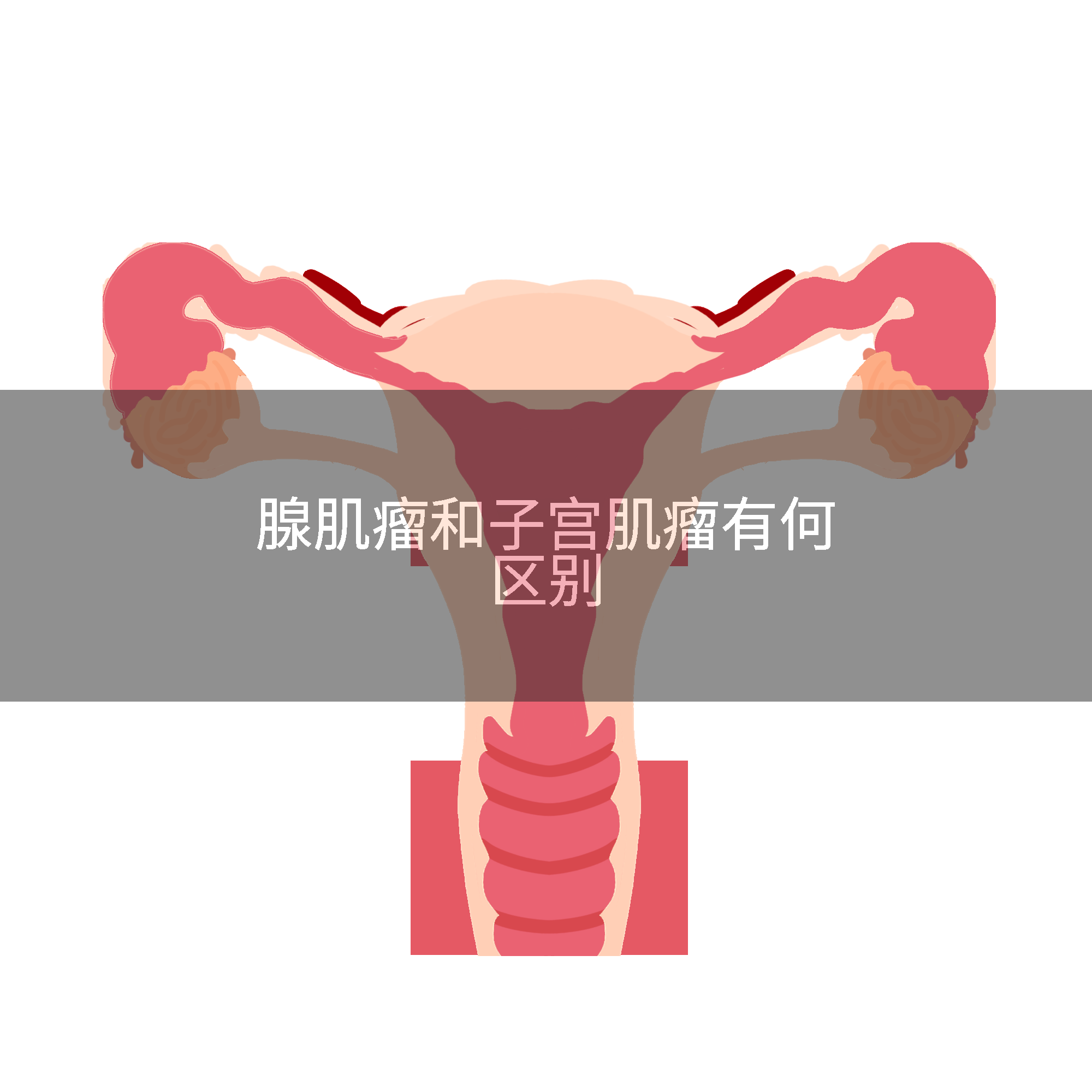 腺肌瘤和子宫肌瘤有何区别